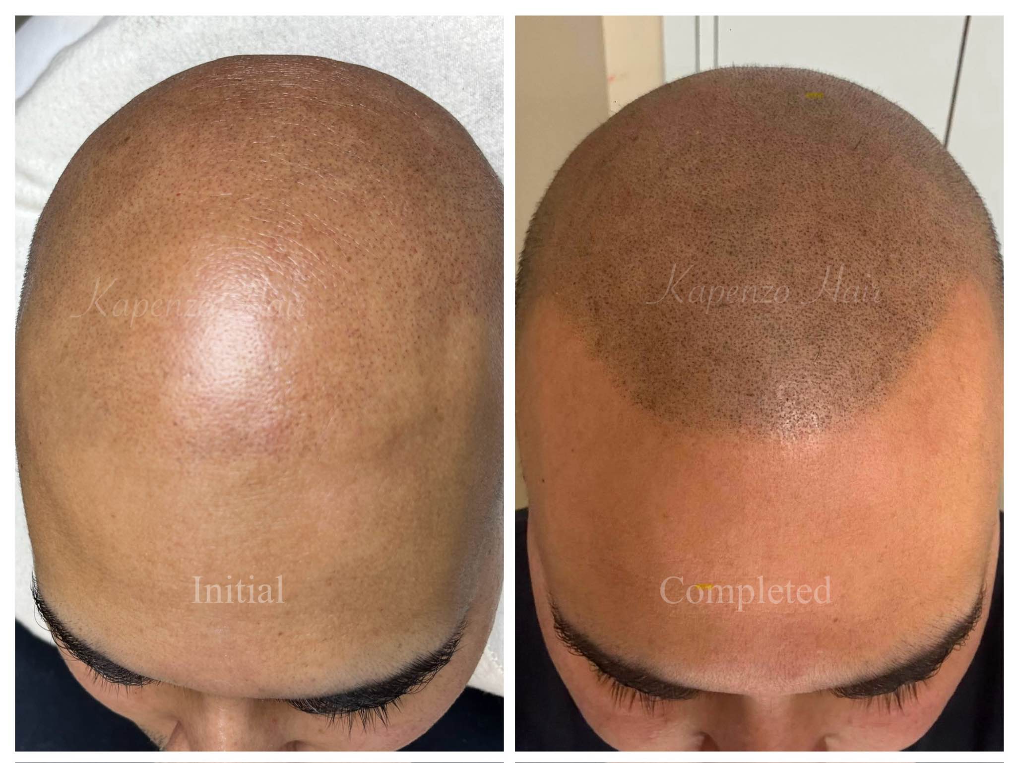 Abi Giummara Facebook ad: Father’s Day Gift, Scalp Micropigmentation- Fuller Hair…