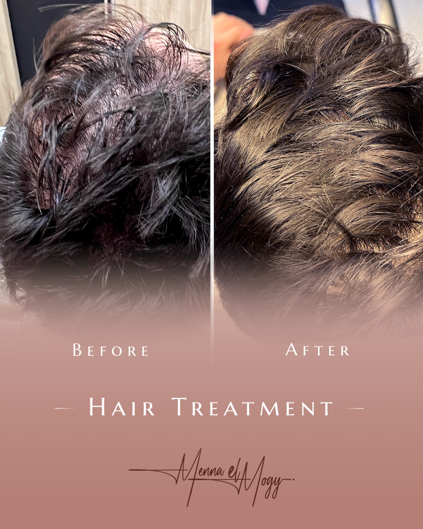 د. منة الموجي - Dr. Menna Elmogy Facebook ad: Advanced treatments, visible results.