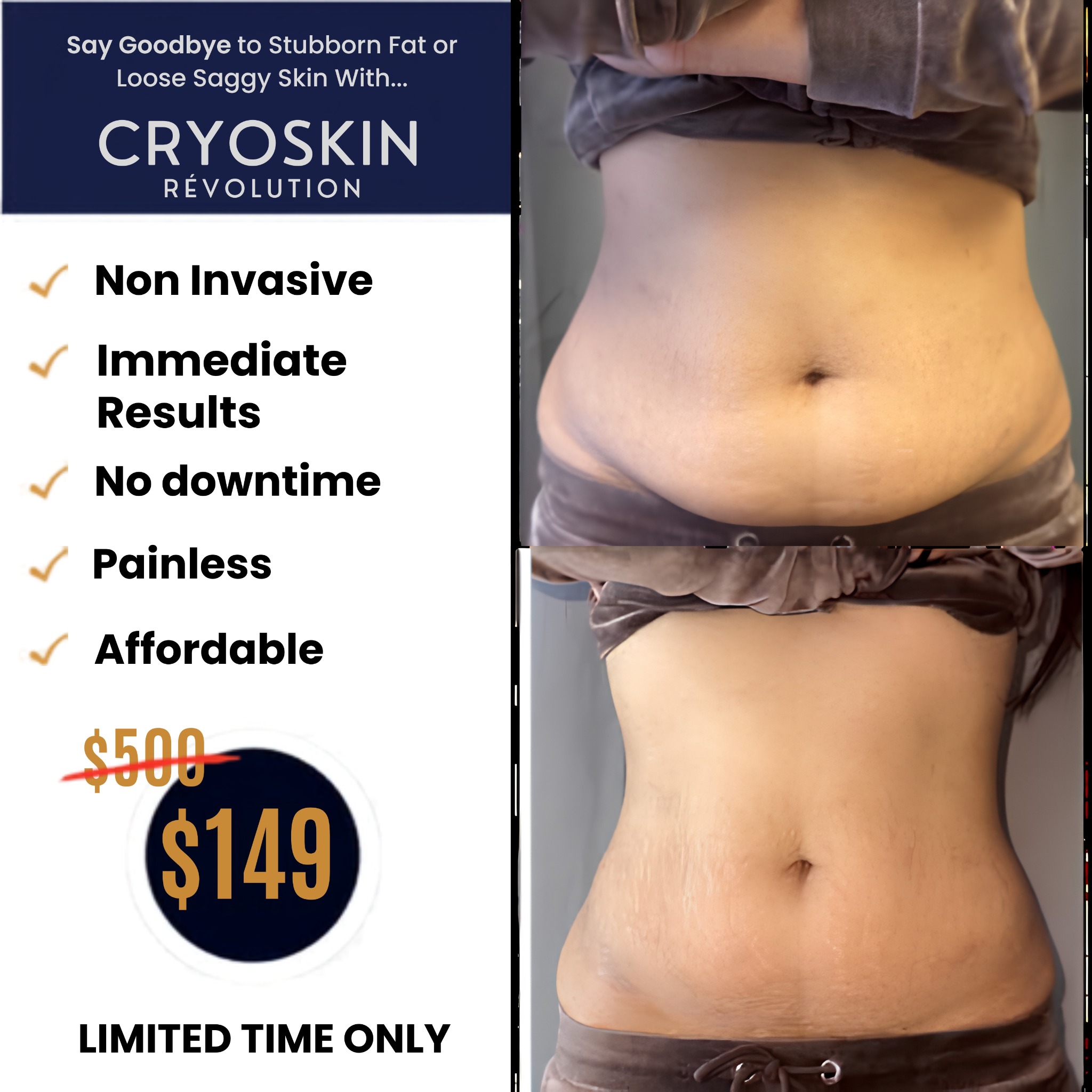 US Cryotherapy - Fort Hood Facebook ad: From $500 to $149 Real Results Start Here!