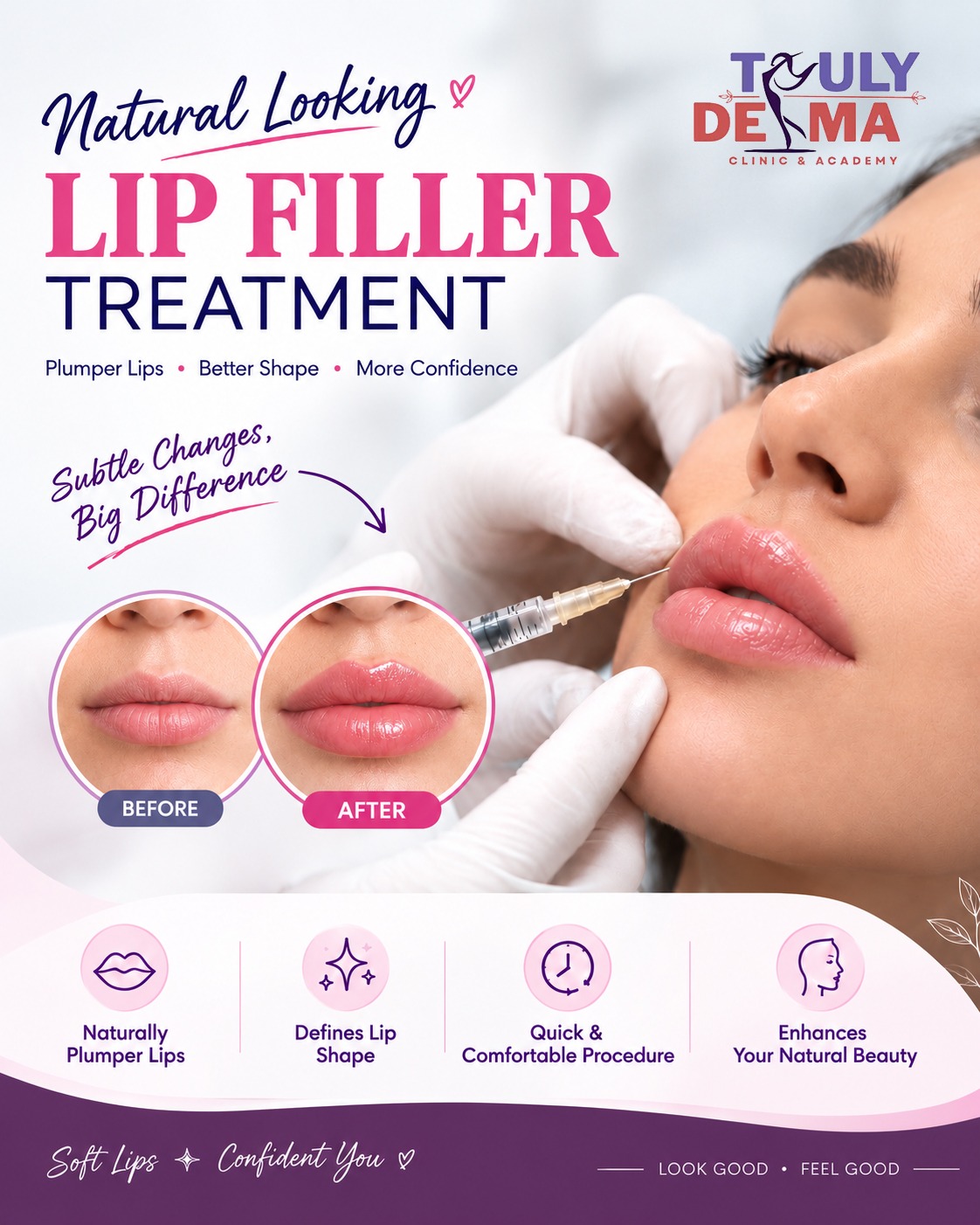 Truly Derma - Pitampura Facebook ad: Natural Looking Lip Fillers