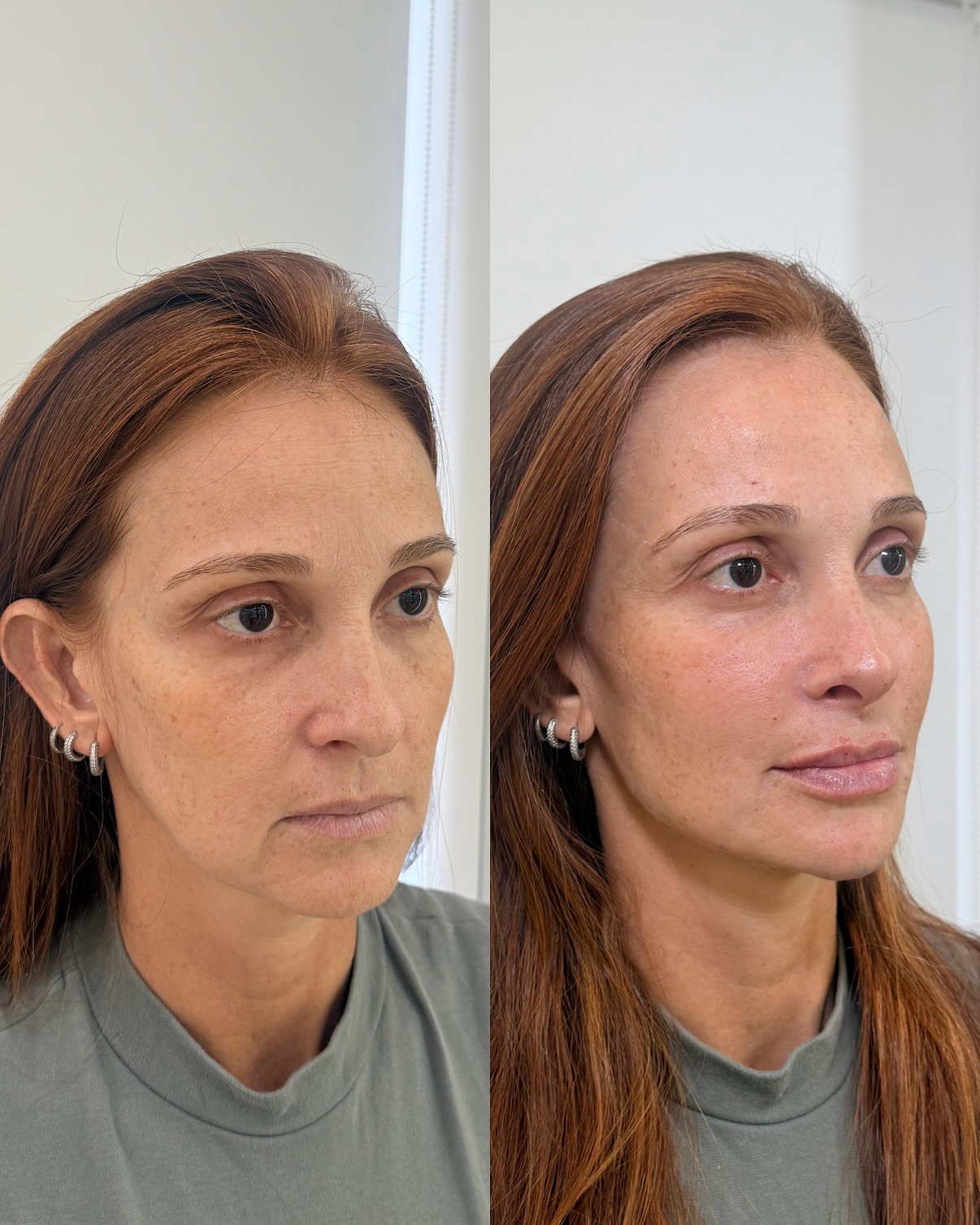 dra.carolinebarreto Facebook ad: Quando o espelho volta a sorrir para você…