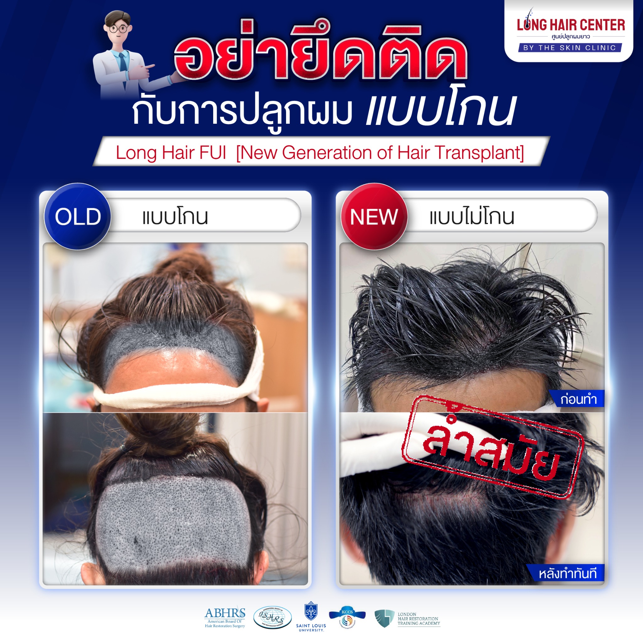 The Skin Clinic Long Hair Center คลินิก รักษาผมร่วง ผมบาง ครบวงจร Facebook ad from Jun 15, 2025