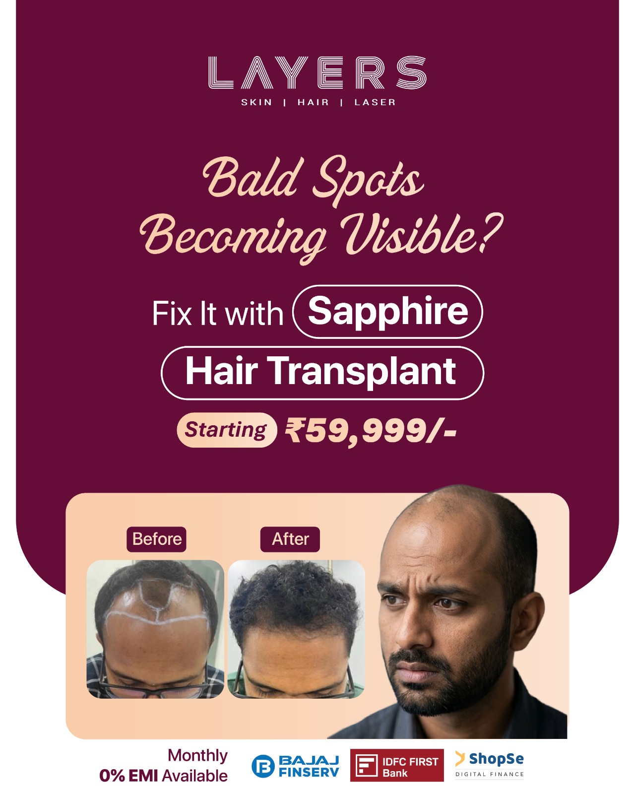 Layers Clinics - Skin & Hair Facebook ad