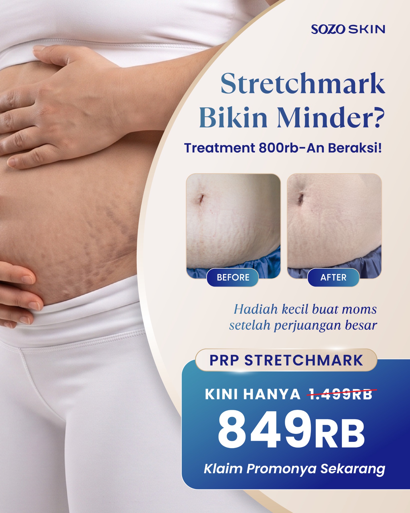 Sozo Skin Clinic Facebook ad