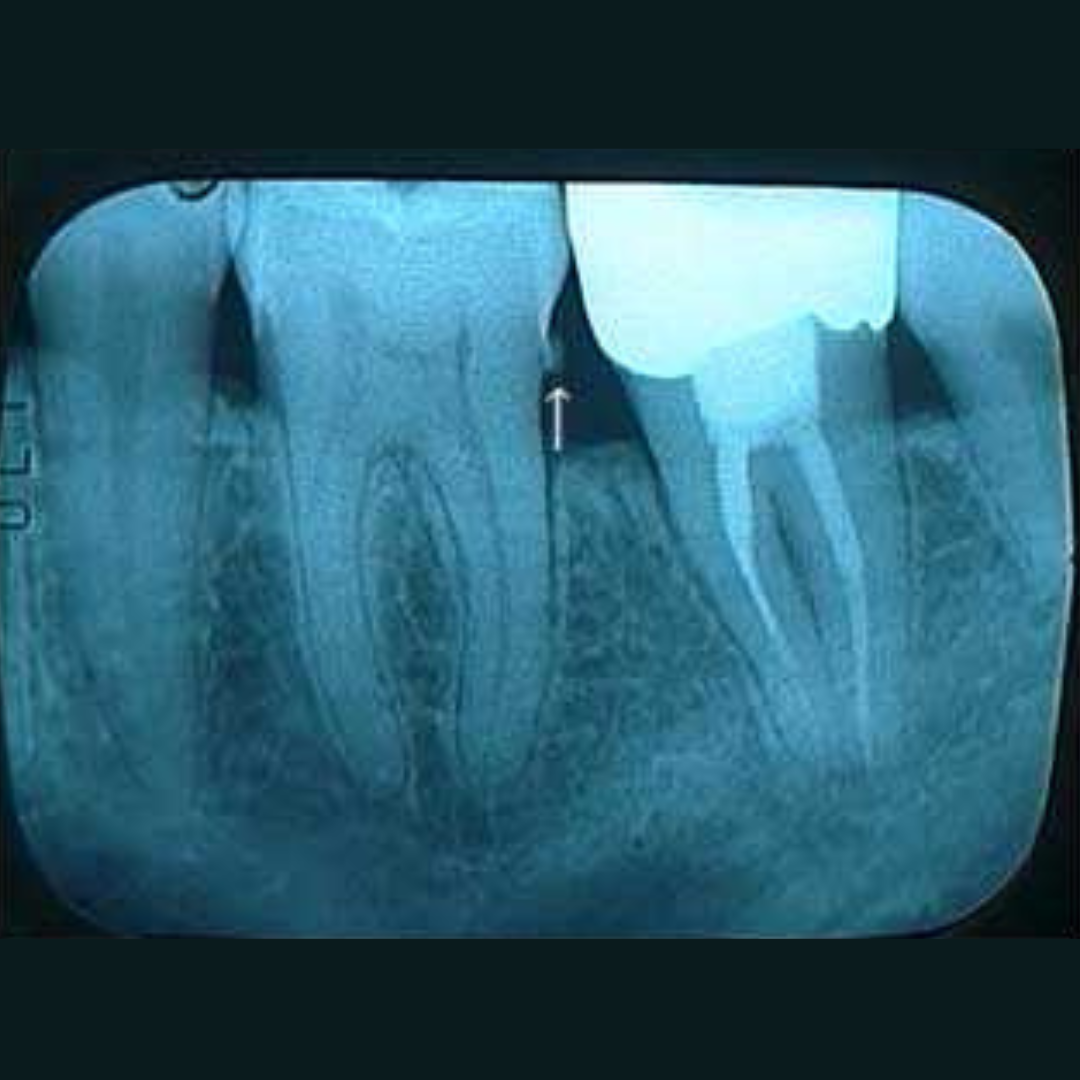 Jennifer Callahan Facebook ad: Truth About Receding Gums