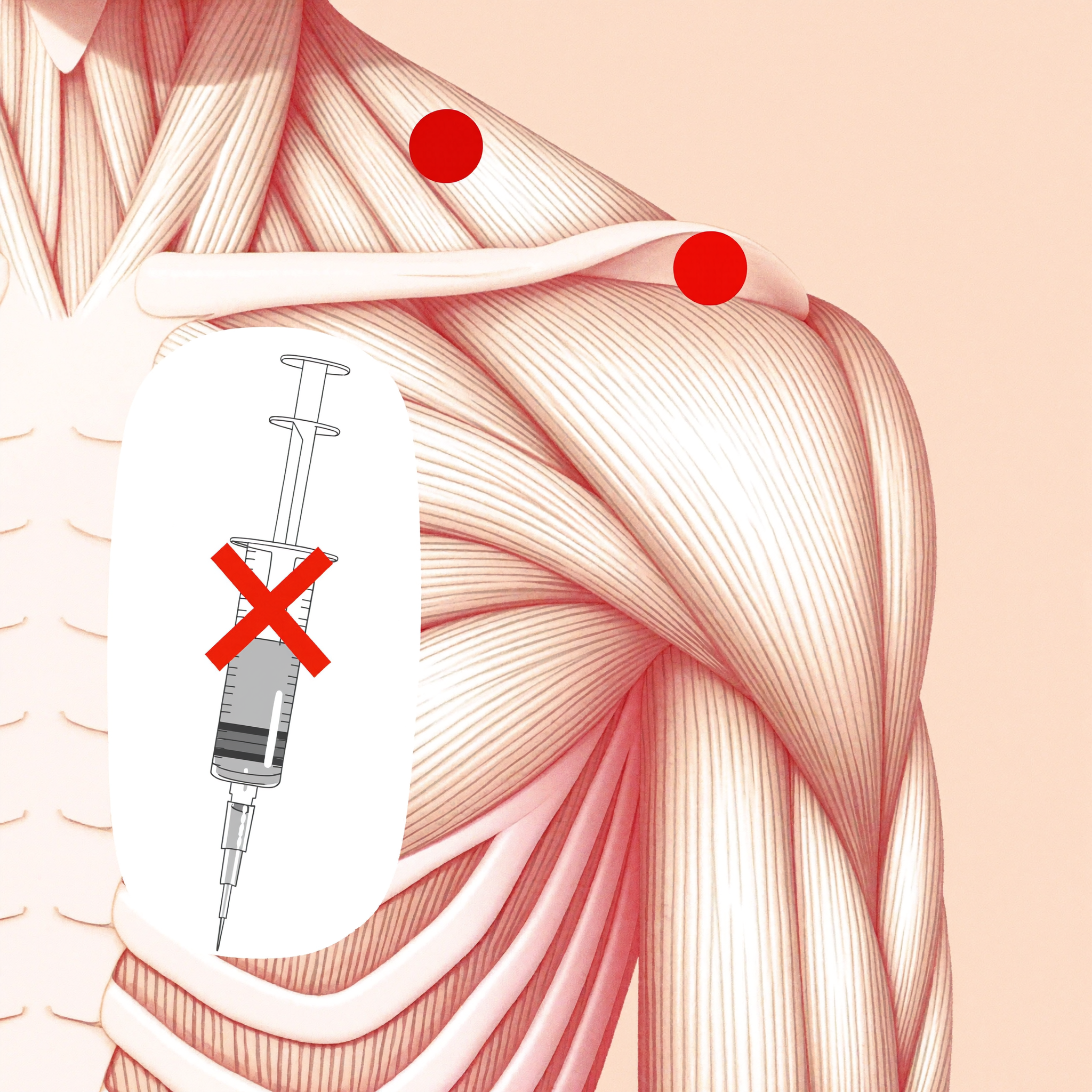 Ryan Callum Facebook ad: End That Chronic Pain in 3 Weeks