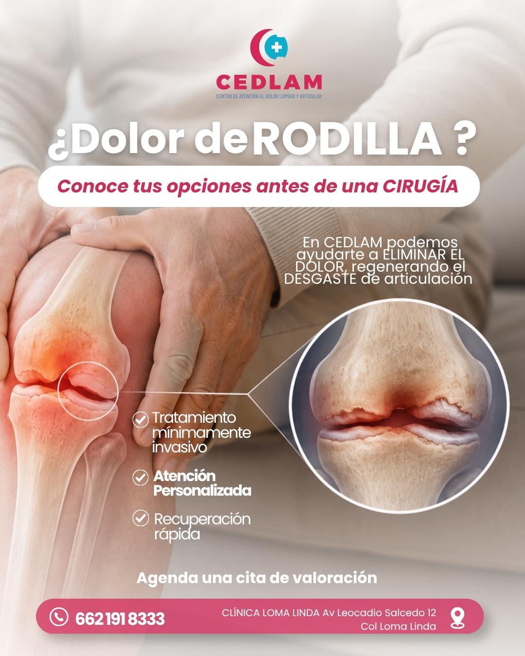 Cedlam Hermosillo Facebook ad: ¿DOLOR DE RODILLA AL CAMINAR?