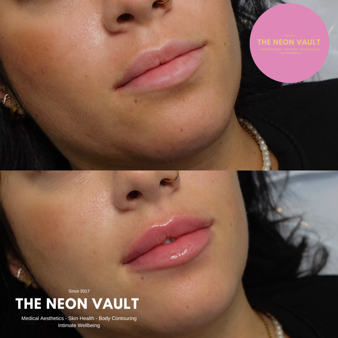 The Neon Vault Facebook ad