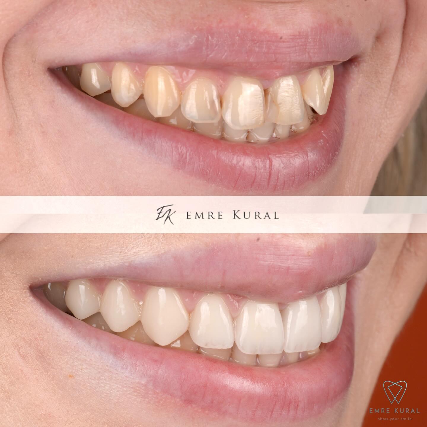 dr.emrekural Facebook ad: Natural Smile Design