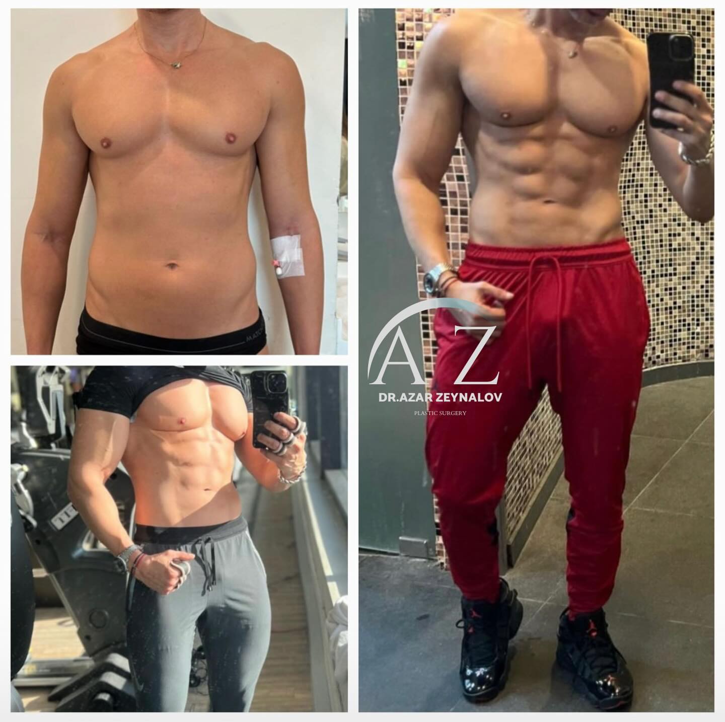 Dr. Azer Zeynalov Facebook ad: The abdominal muscles are located between the belly…