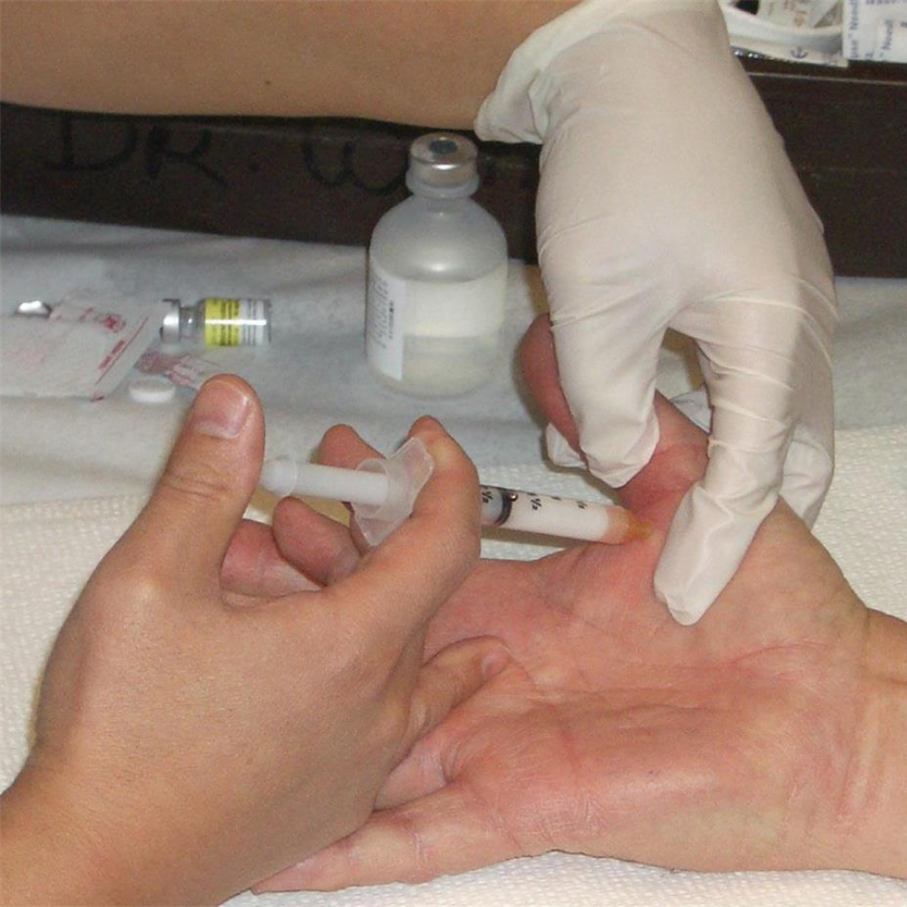 The Menopause Journal Facebook ad: Menopause did this to her hands