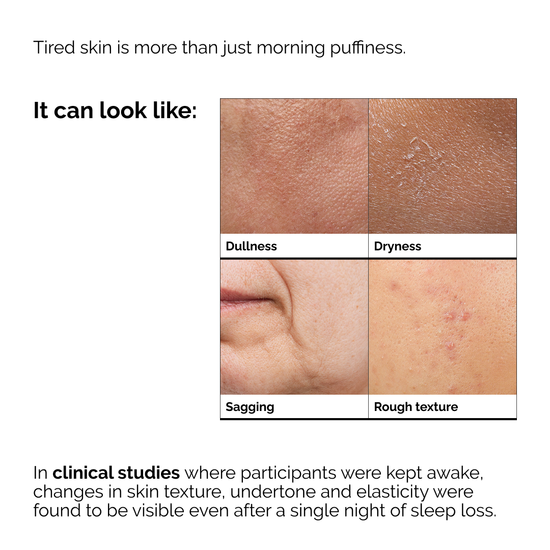 The Ordinary Facebook ad
