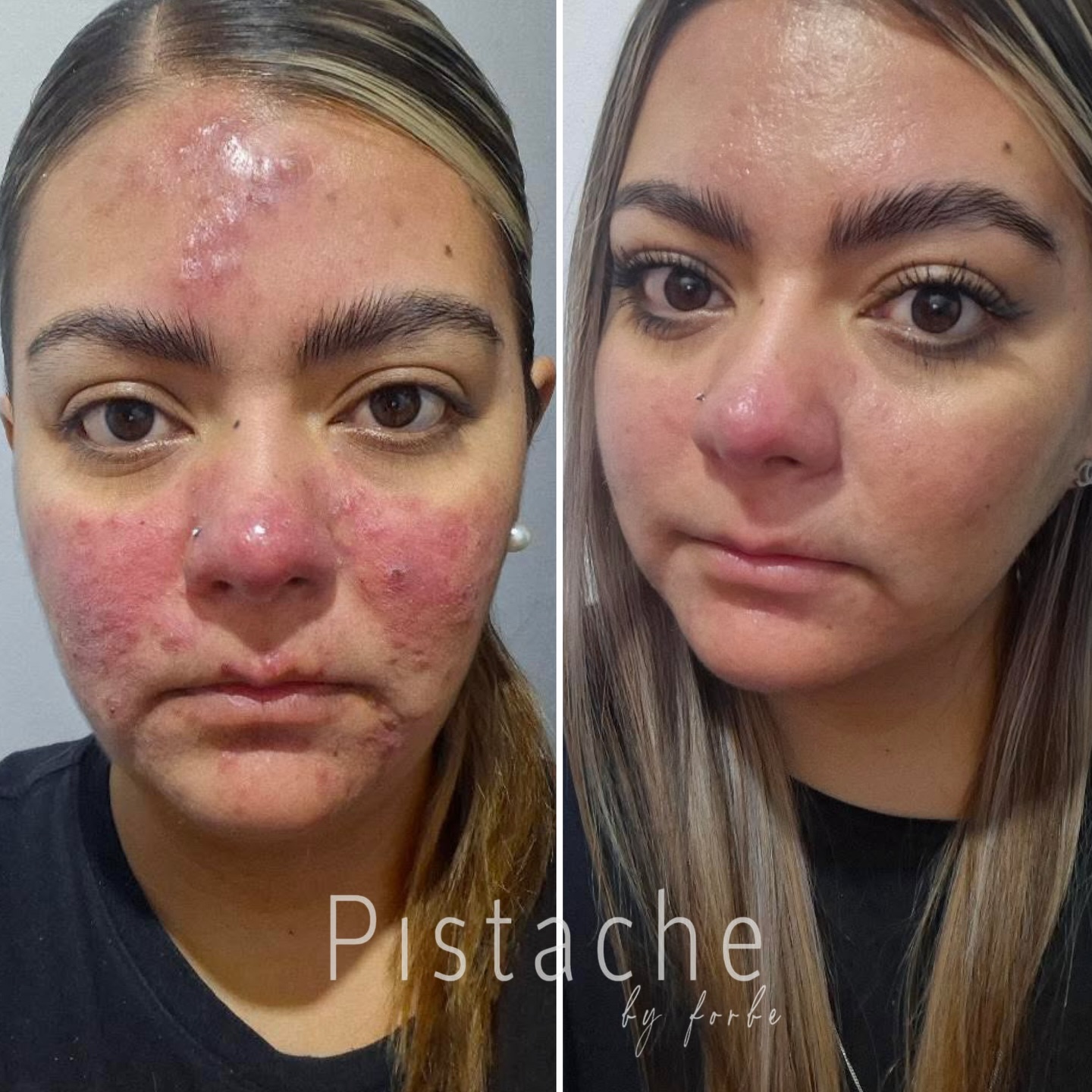 Pistache Facebook ad