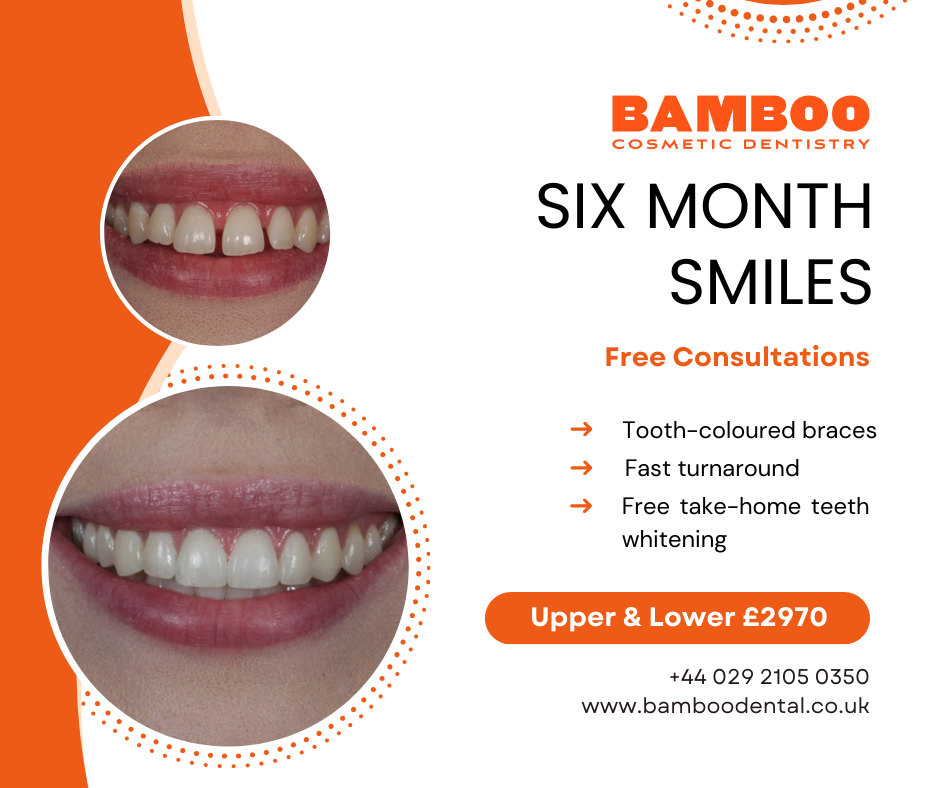 Bamboo Dental Facebook ad