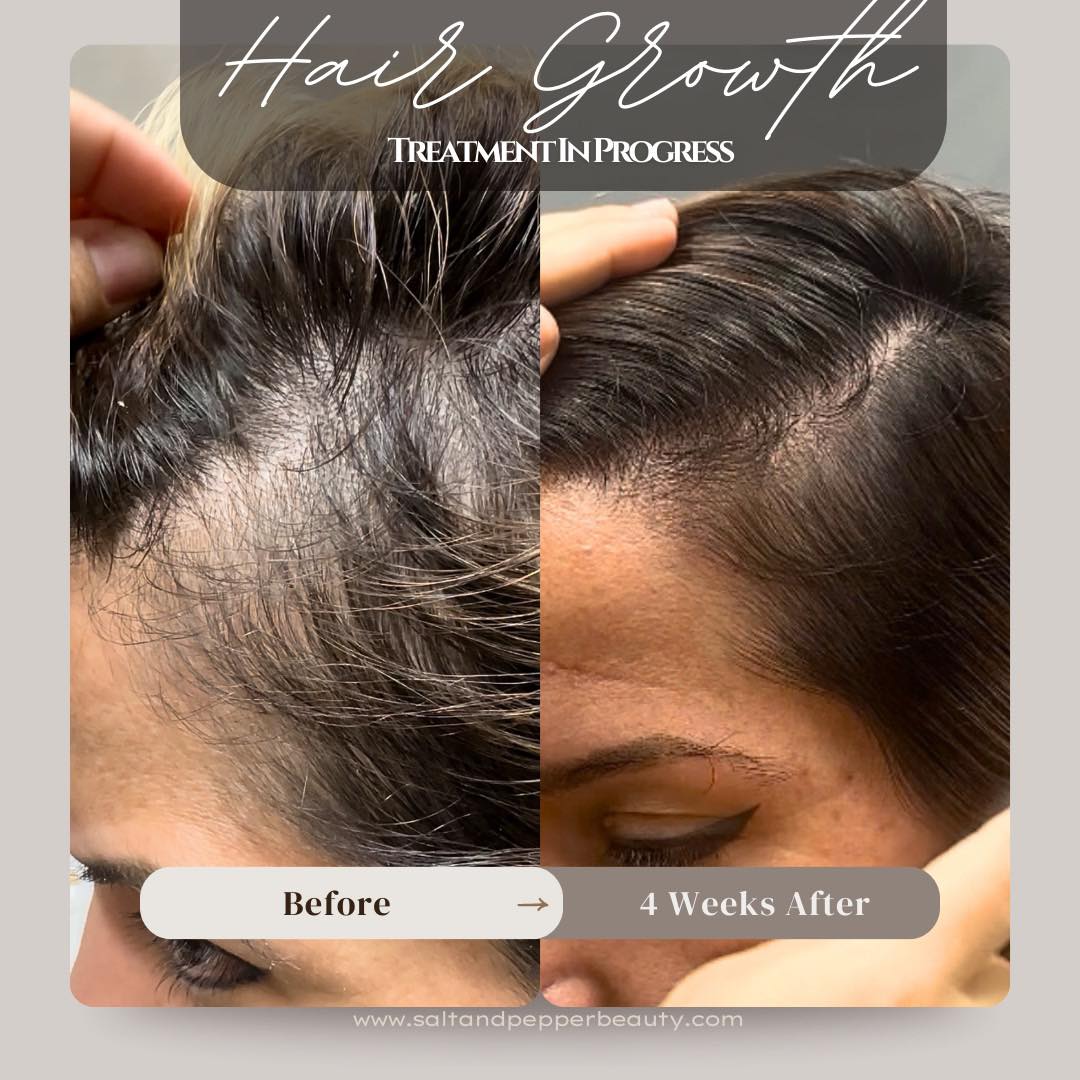 Salt & Pepper Beauty Bar Facebook ad: Why is my hair thinning… I’m only 29?