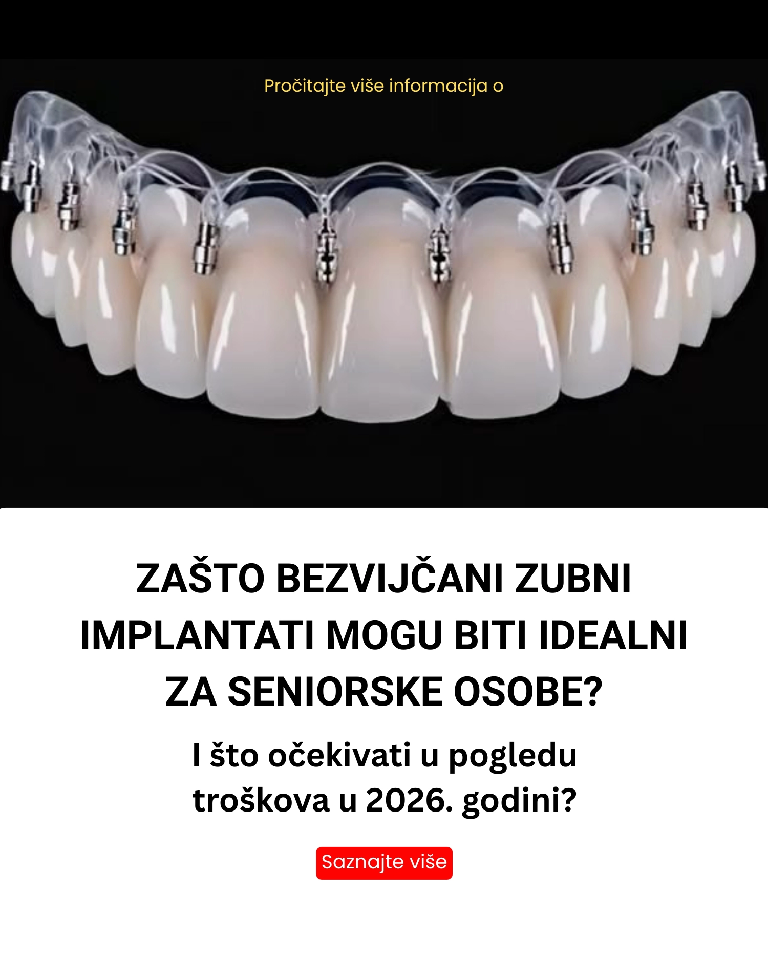 Best choice Facebook ad: Saznajte više o bezvijčanim zubnim implantatima za starije…