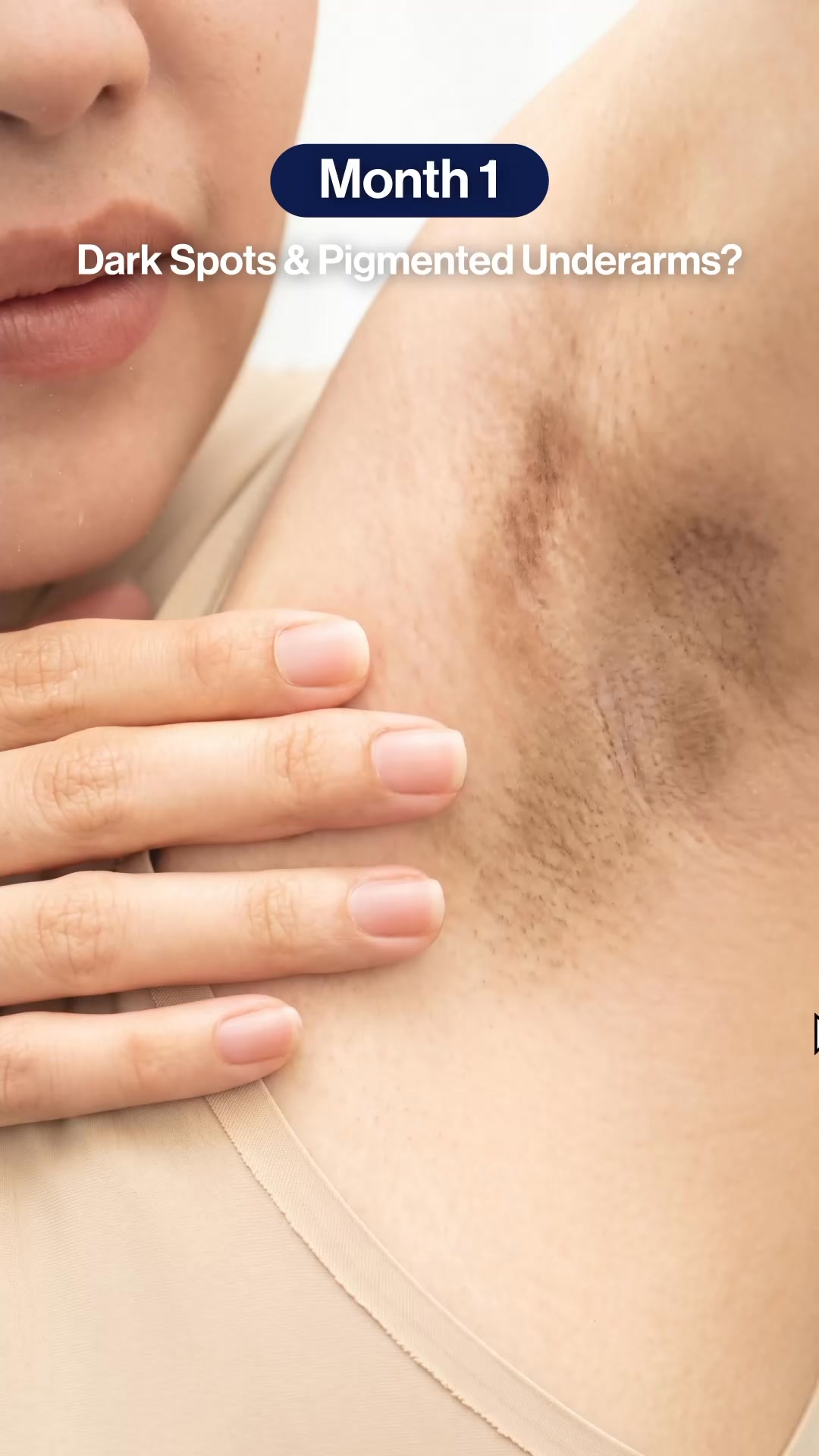 Be Bodywise AE Facebook ad: Do you have severe underarm pigmentation?