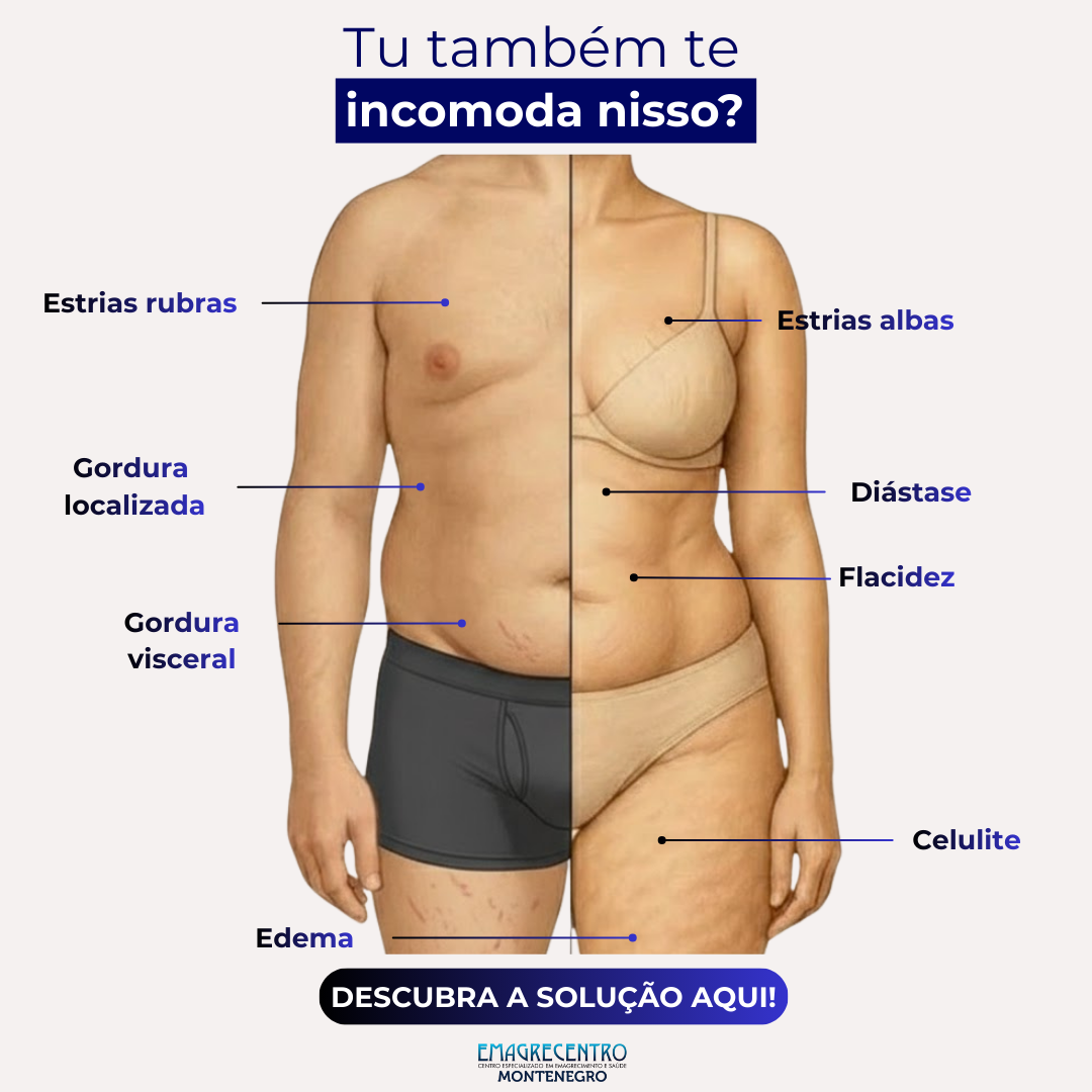 Emagrecentro Montenegro Facebook ad: Emagrecentro Montenegro | Estética Facial e Corporal
