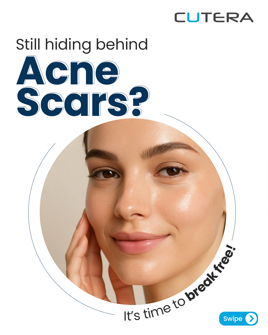 Cutera Aesthetics Facebook ad: Clear skin isn’t a dream-it’s a decision.
