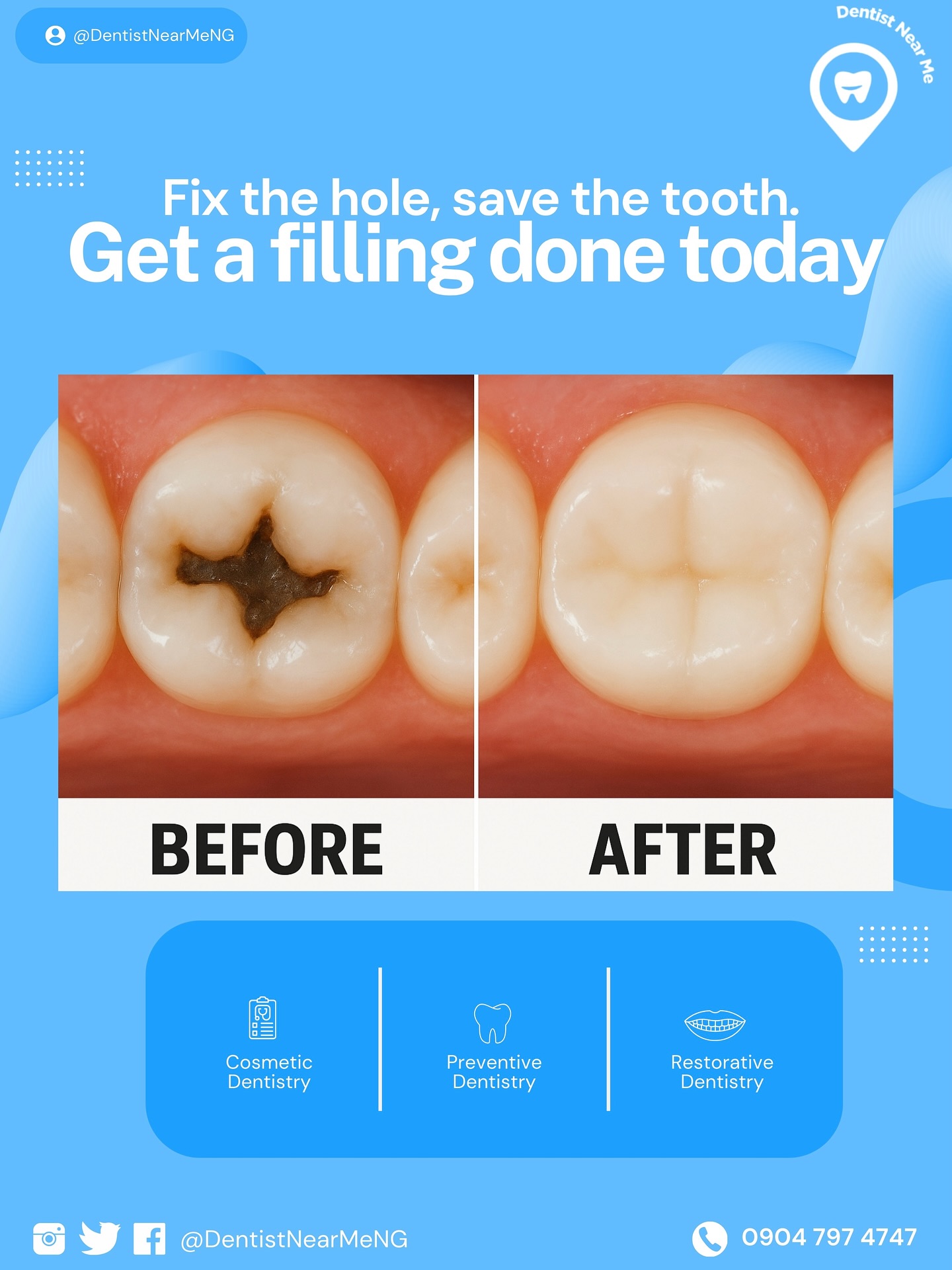 Dentist Near Me Nigeria Facebook ad: Cavities don’t heal on their own, but with…