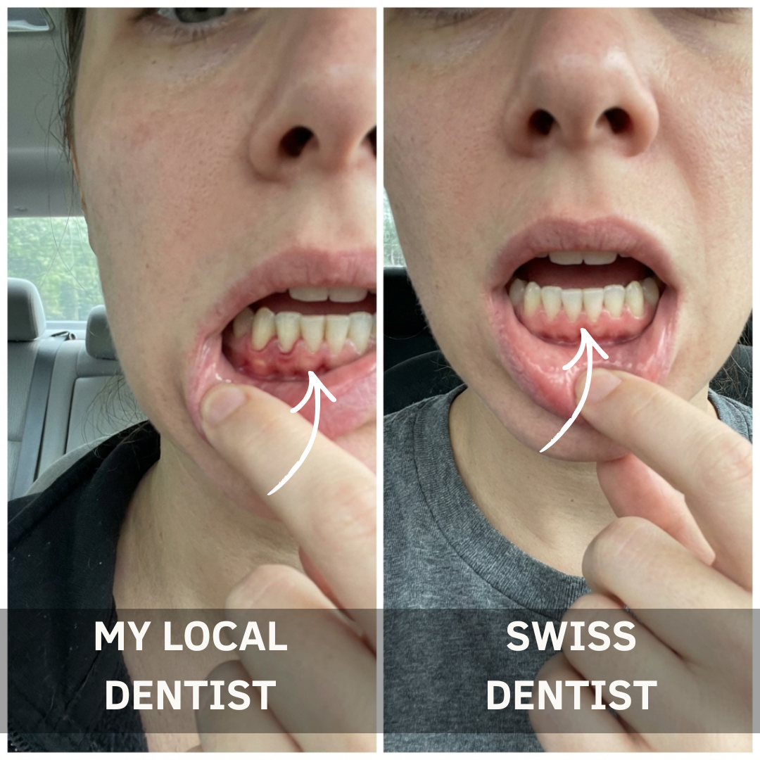 Oral Health Central Facebook ad: Before You Schedule That Gum Graft Surgery, Read This.