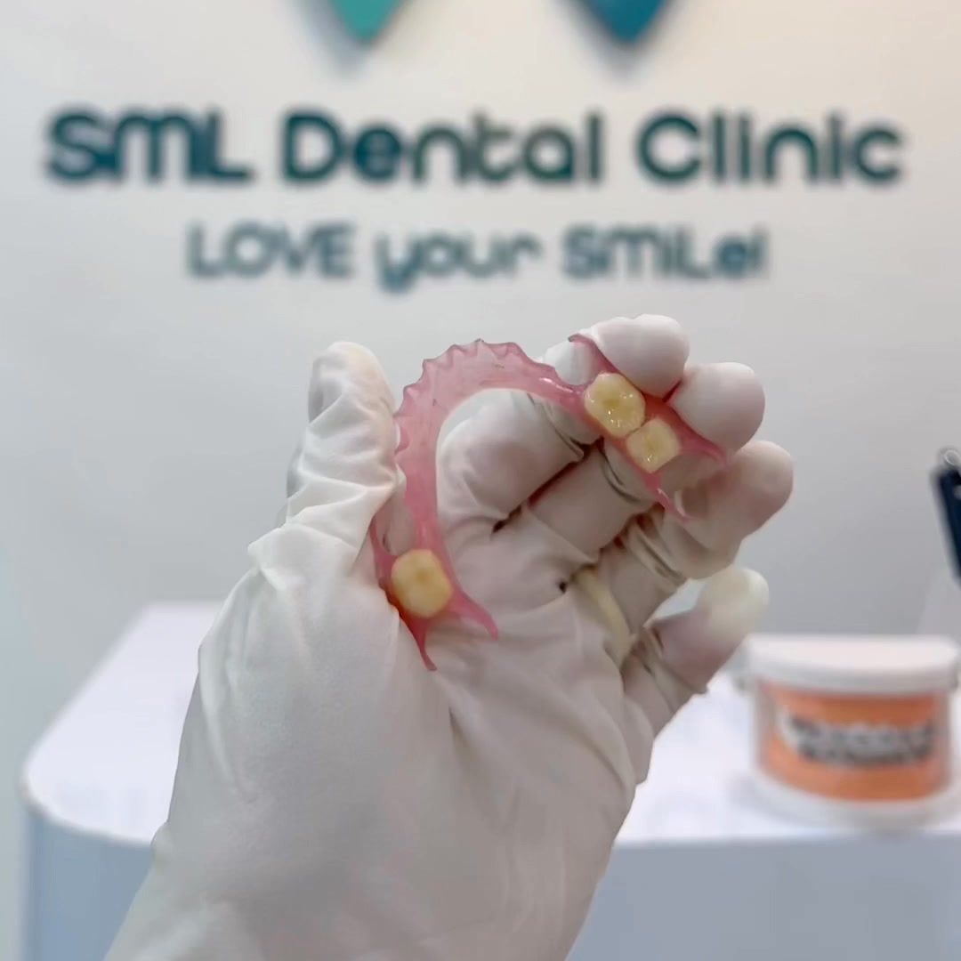 SML Dental Clinic Facebook ad from Nov 4, 2025