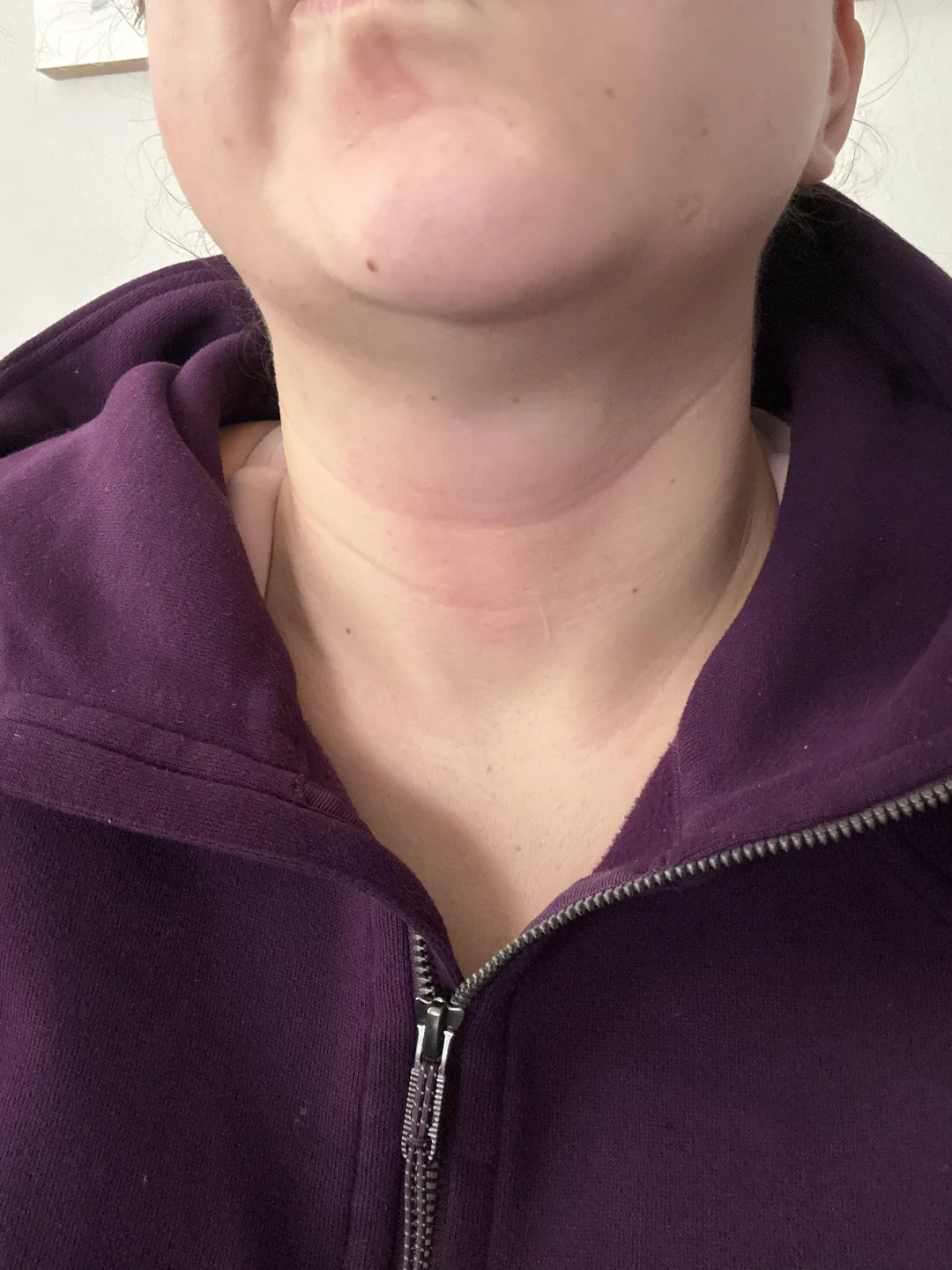 Thyroid Health Daily Facebook ad: Read this if you're scared to take GLP-1