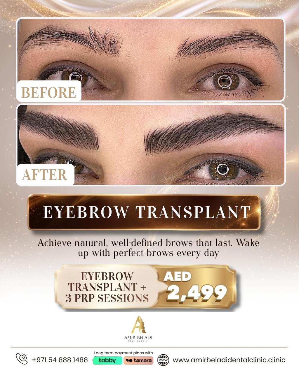 Amir Beladi Polyclinic Facebook ad: That after is not makeup.