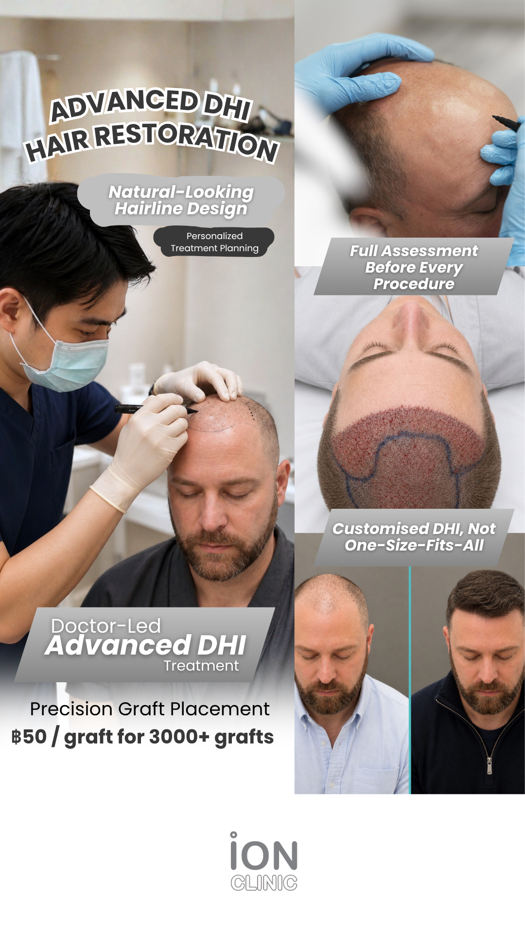 ION Clinic Bangkok Facebook ad