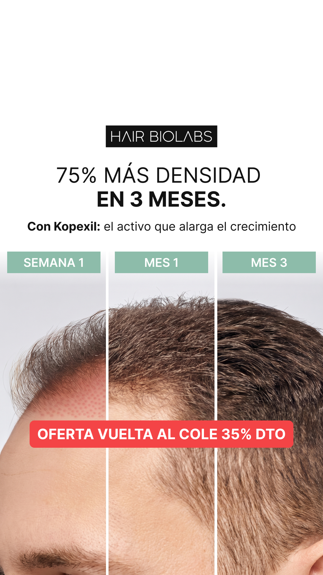 Hair Biolabs Facebook ad: Mi peluquera notó el cambio antes que yo