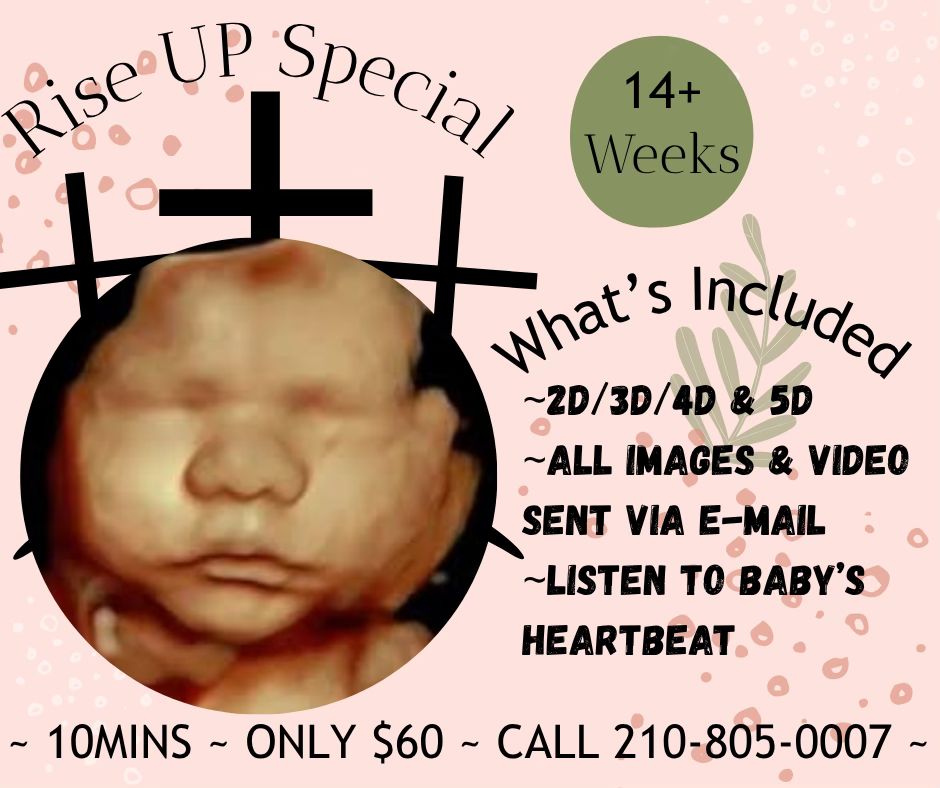 BabyVision Ultrasound Facebook ad: Appointments | BabyVision Ultrasound