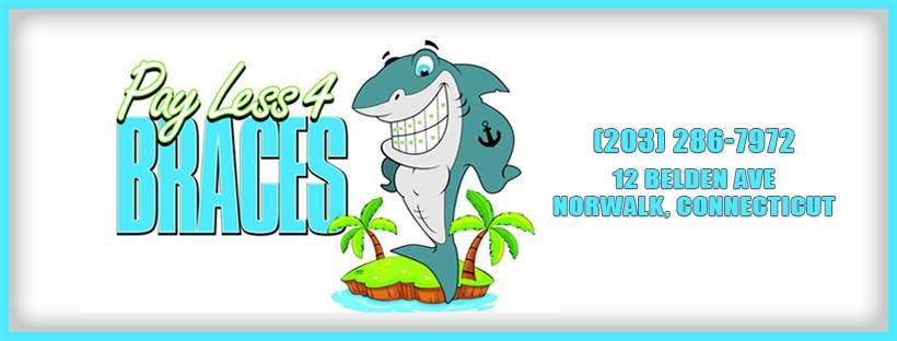 Pay Less 4 Braces - Connecticut Facebook ad: Same day Braces with $350 down, and just…