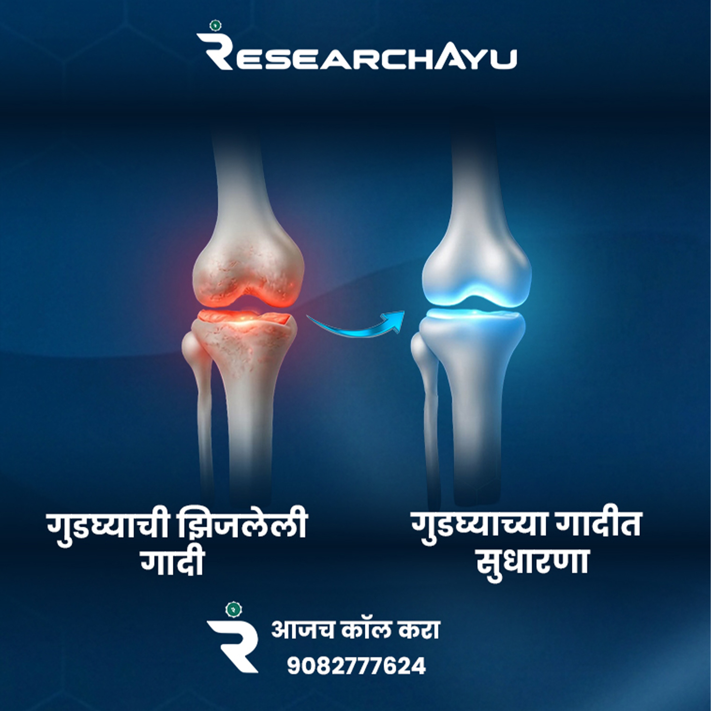 Research Ayu Knee Health Facebook ad