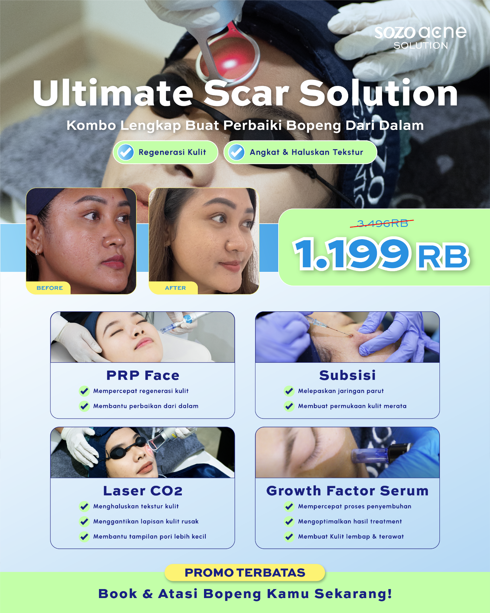 Sozo Acne Facebook ad