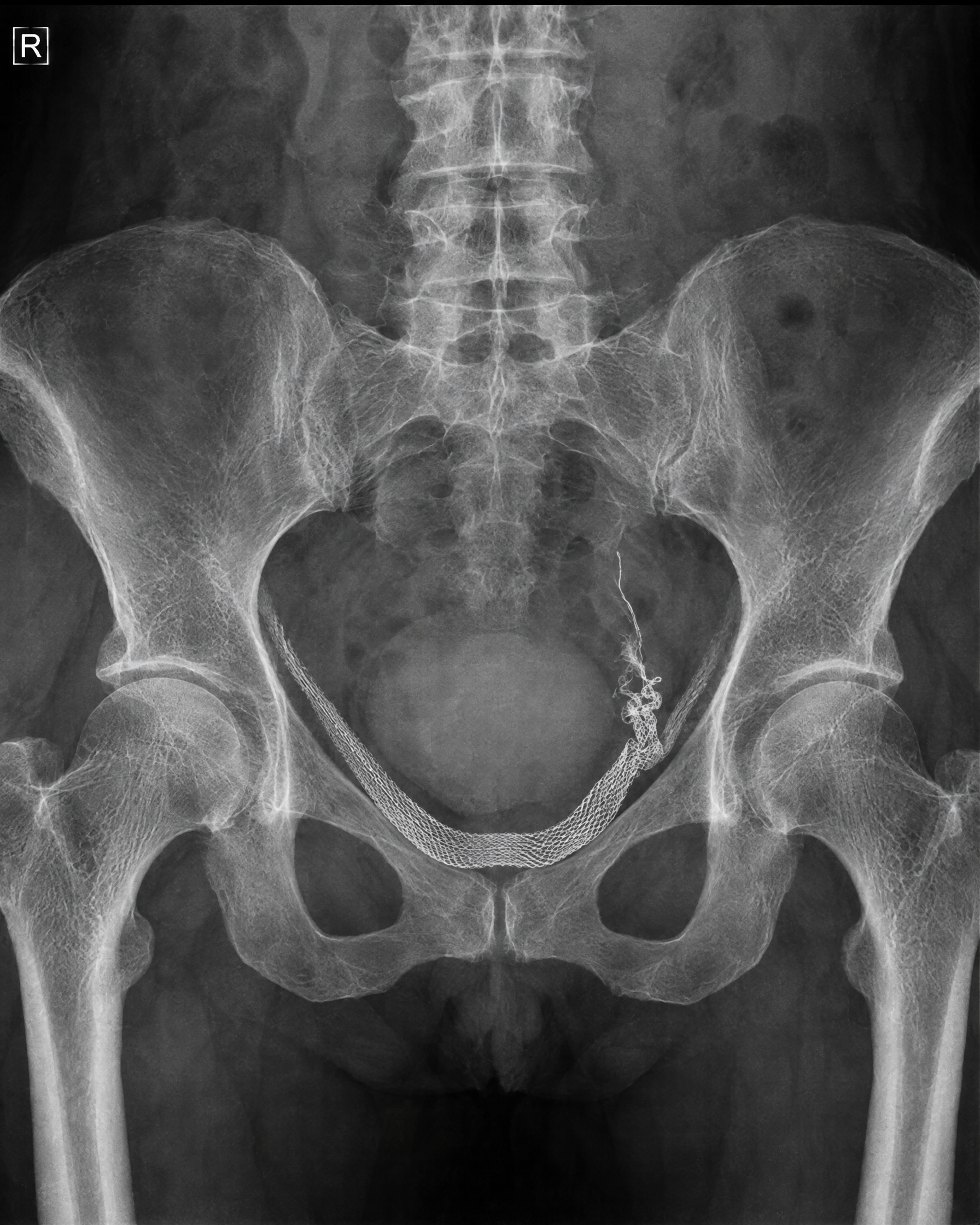 Dr. Patricia Sullivan Facebook ad: My mother's sling took 4 surgeries. I said NO.
