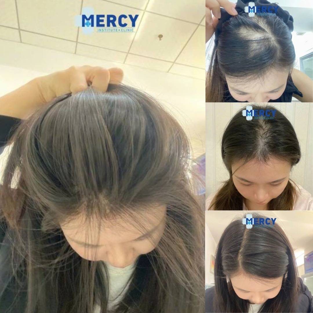Mercy Institute Clinic Facebook ad: How did Mercy customers 'CURE BALDNESS'?