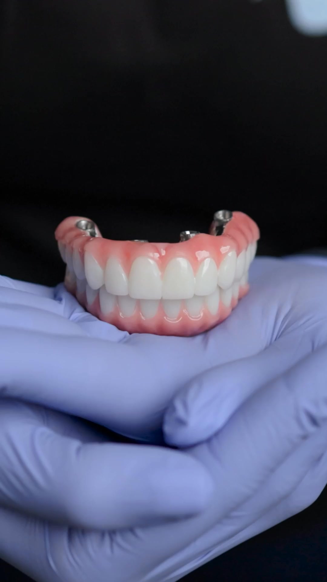 Nuvia Dental Implant Center Facebook ad: New Permanent Teeth Are Just 24 Hours Away!