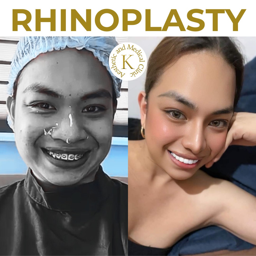 K Aesthetic and Medical Clinic Facebook ad