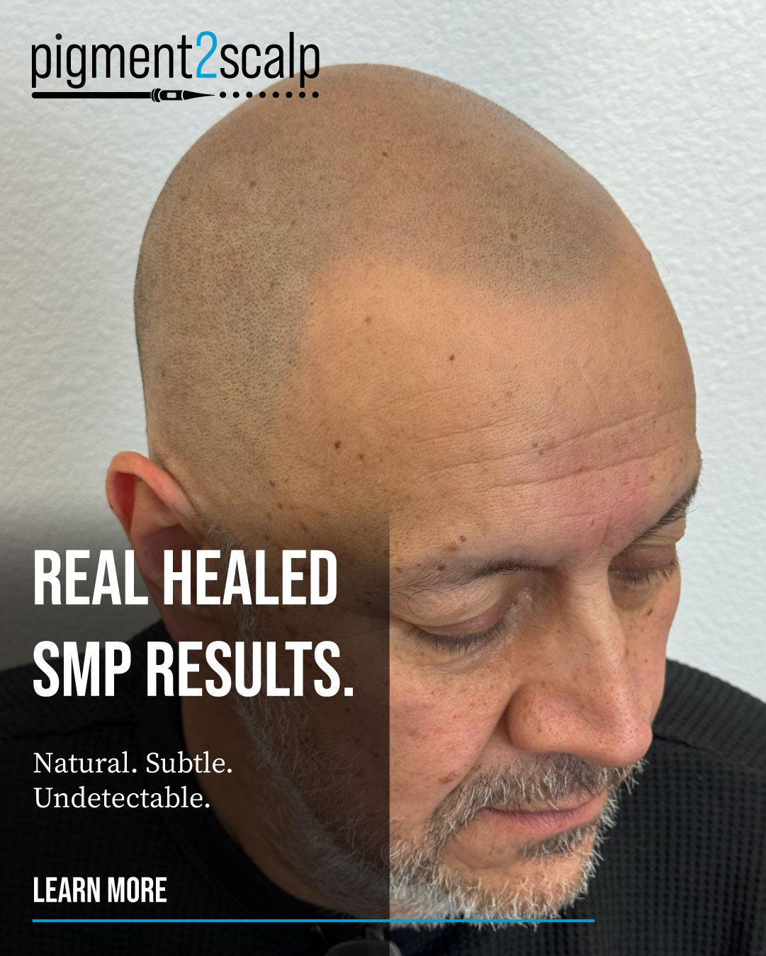 Pigment2scalp Micropigmentation Facebook ad from Apr 29, 2026