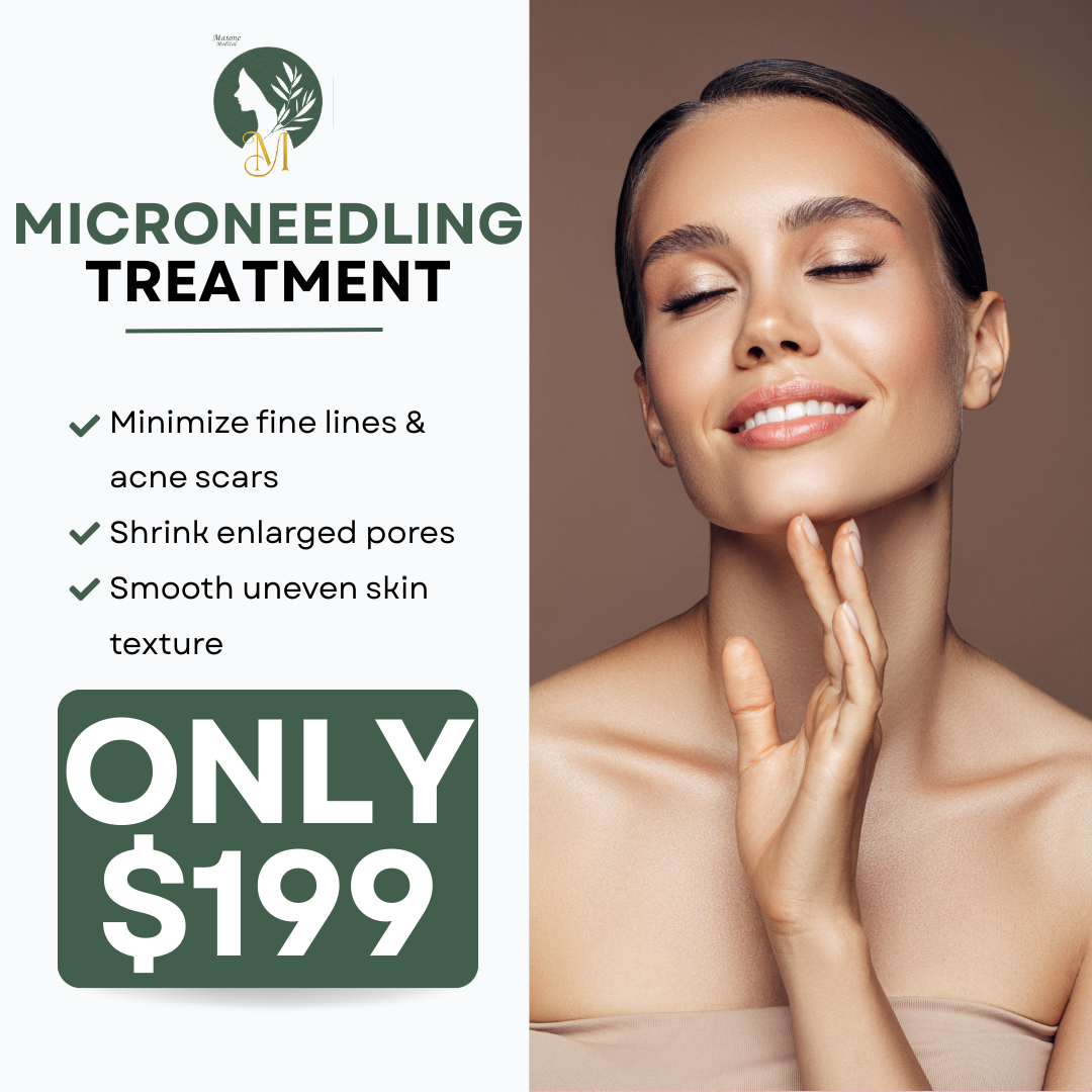Masone Medical Aesthetics Facebook ad: $199 Microneedling Treatment (Reg. $250)