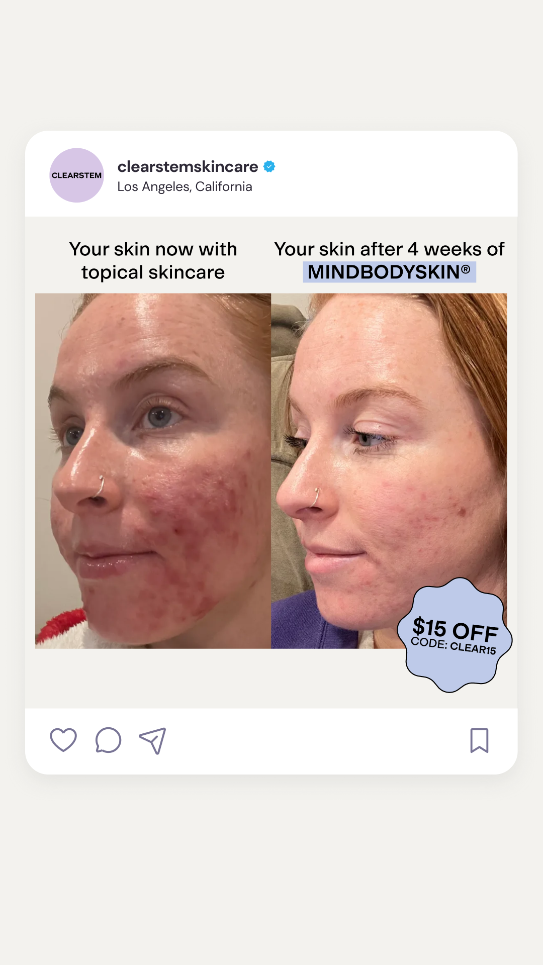CLEARSTEM Skincare Facebook ad