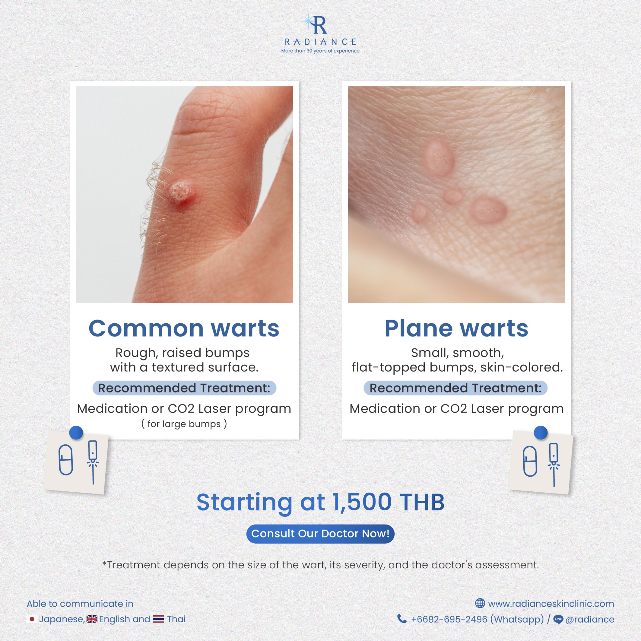 Radiance Clinic Facebook ad: Worried about a stubborn wart?