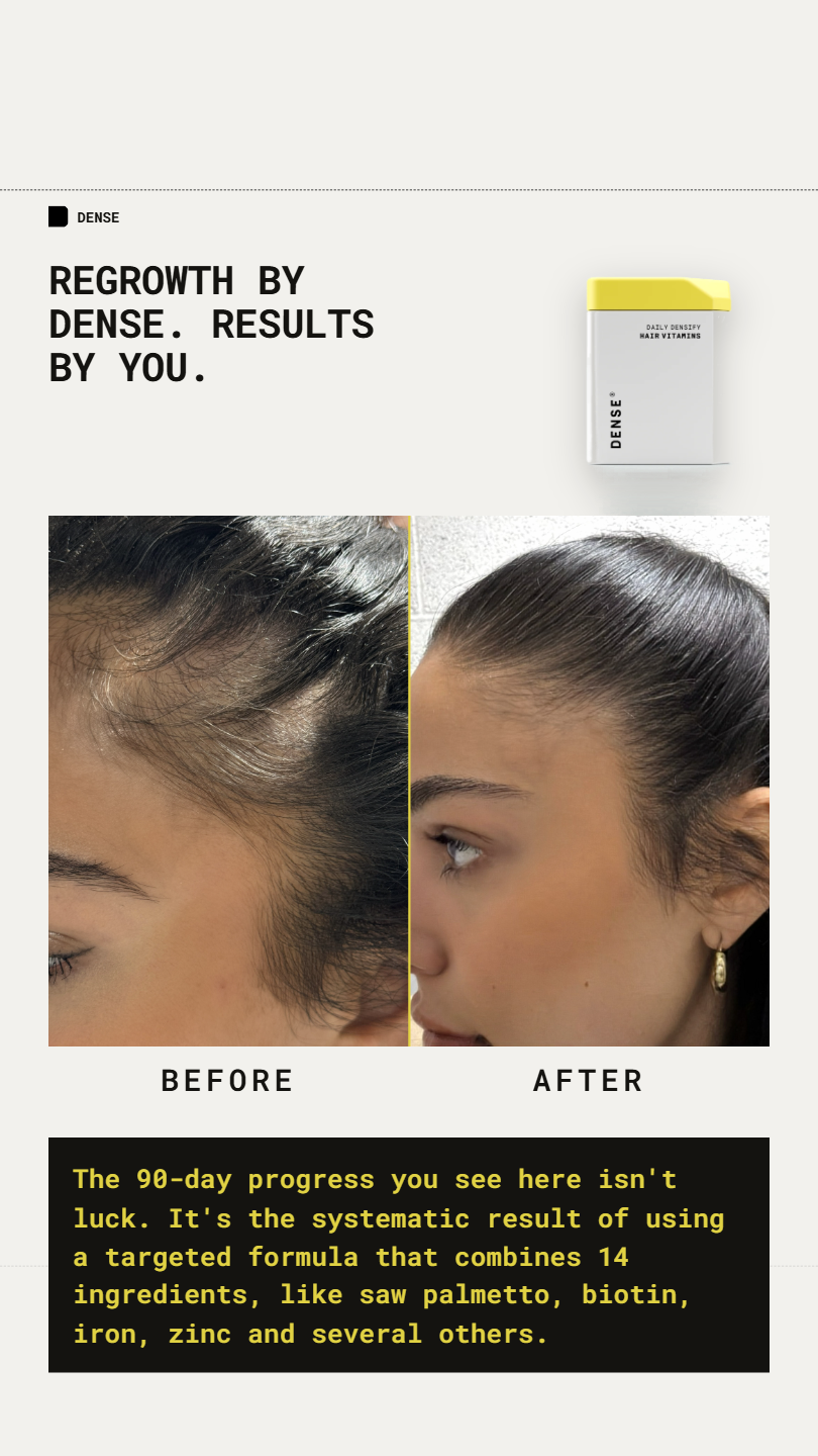 Dense Hair Experts Facebook ad