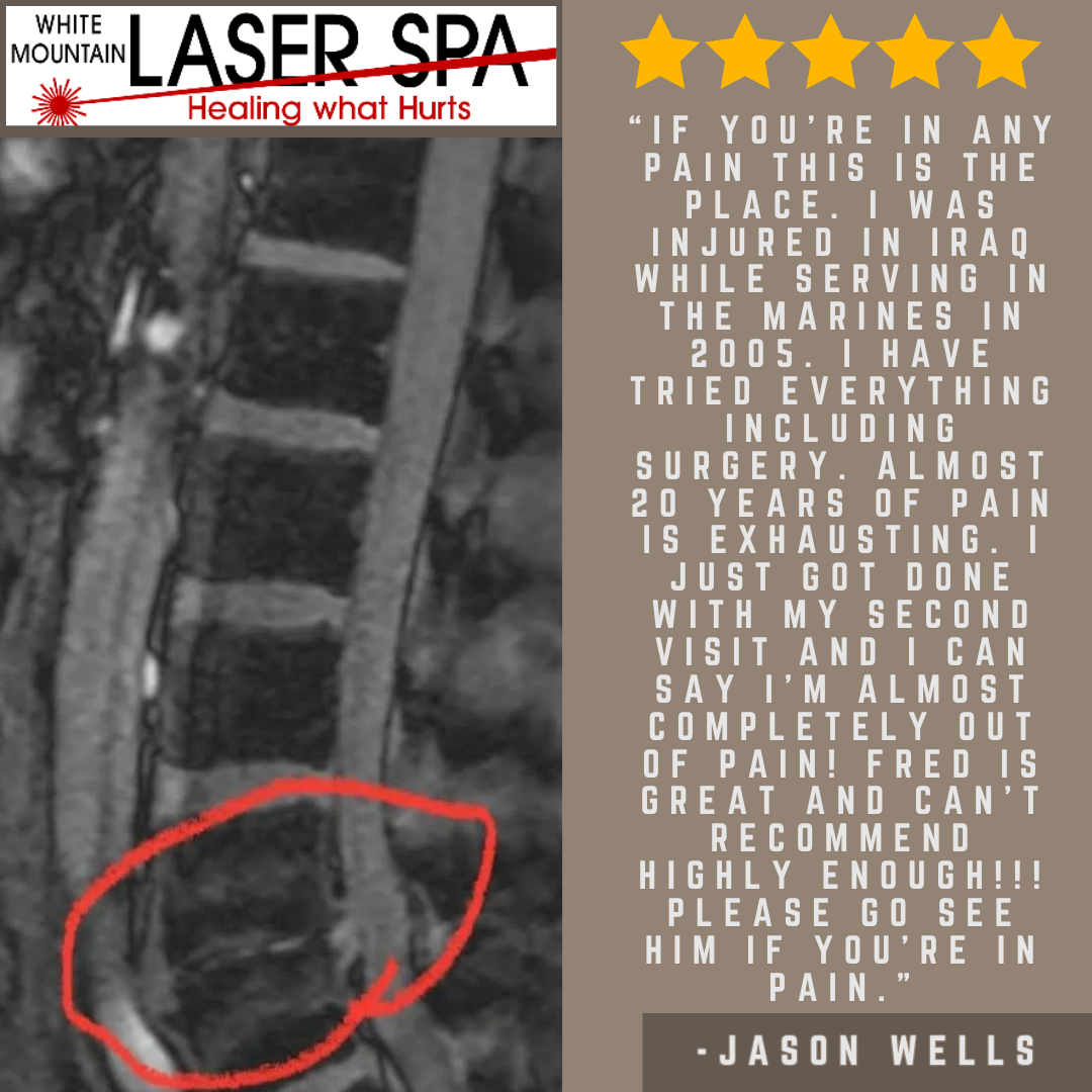 White Mountain Laser Spa, LLC Facebook ad from Apr 6, 2026