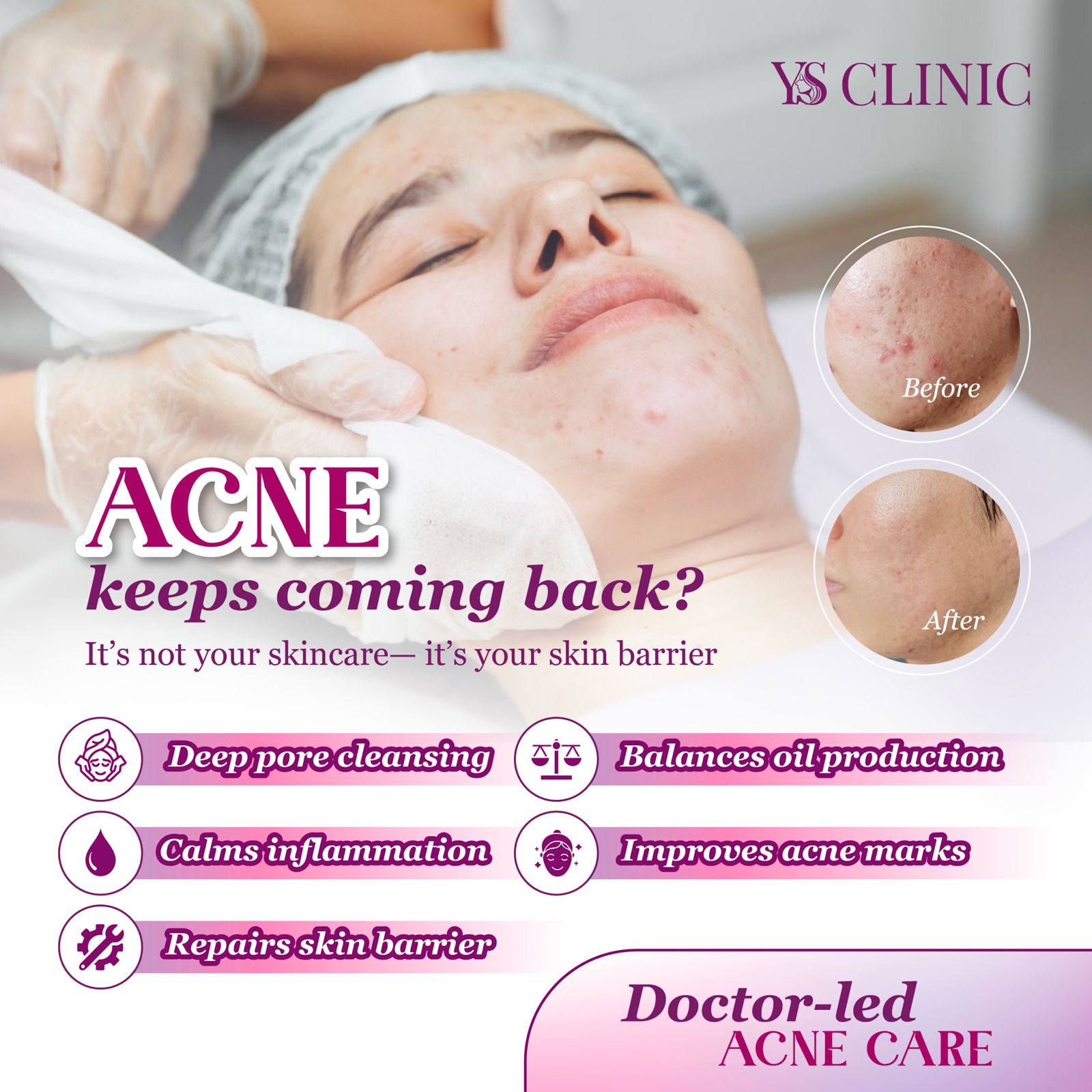 YS Aesthetic Clinic Facebook ad