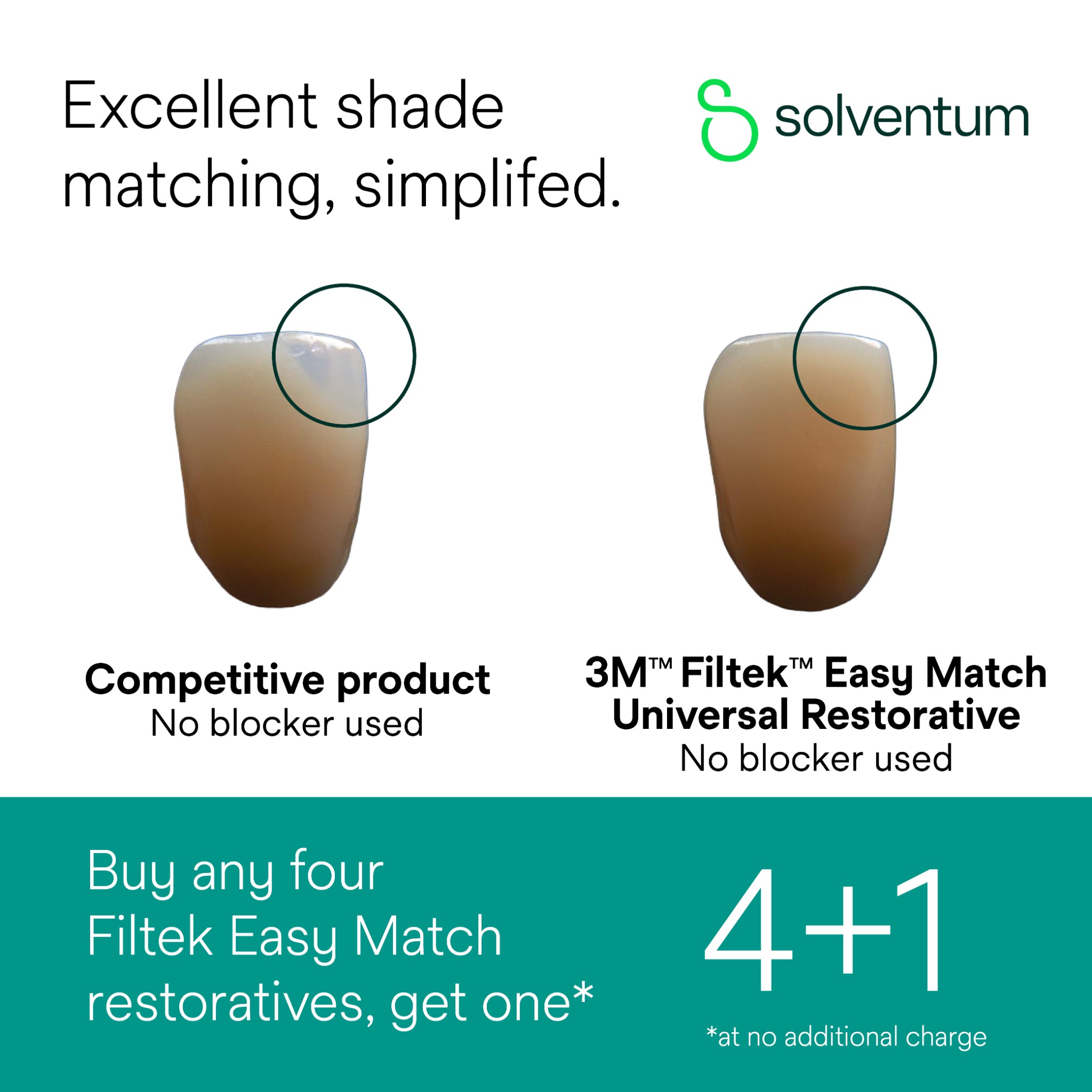 Solventum Dental Facebook ad: Simplify your restorative workflow.