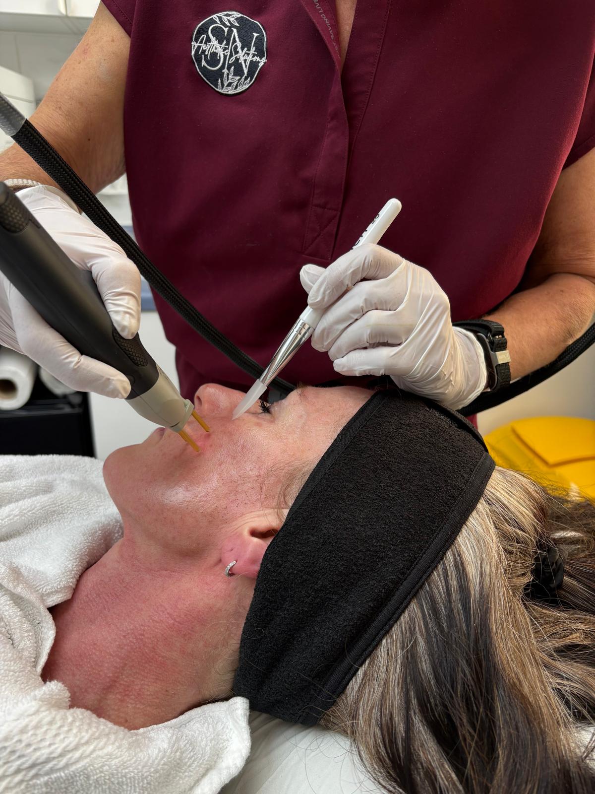 sn_aesthetic_solutions Facebook ad: NeoGen | Full Face and Neck | Now Only £499! (Usually £950)