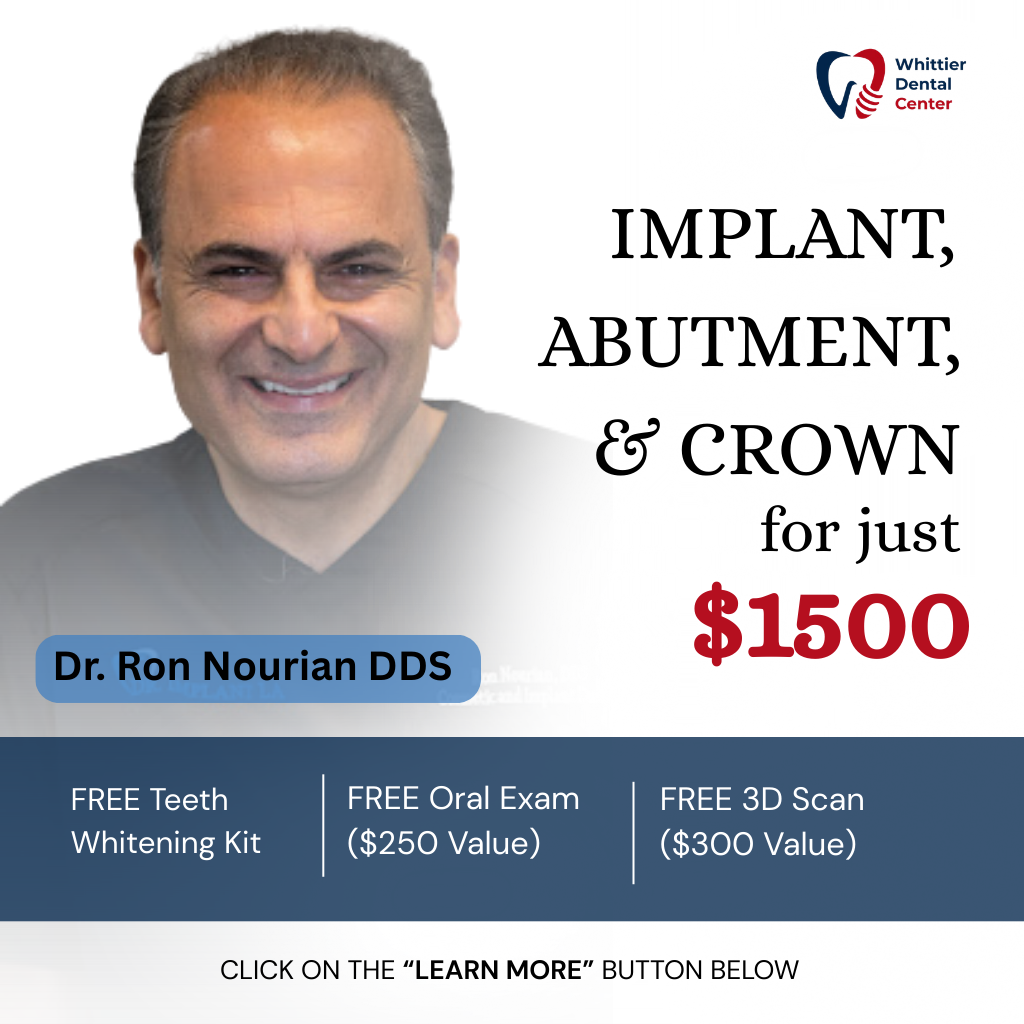 Whittier Dental Center & Orthodontics Facebook ad: Hey Los Angeles -New Year Hottest Deal: Implant, Abutment…
