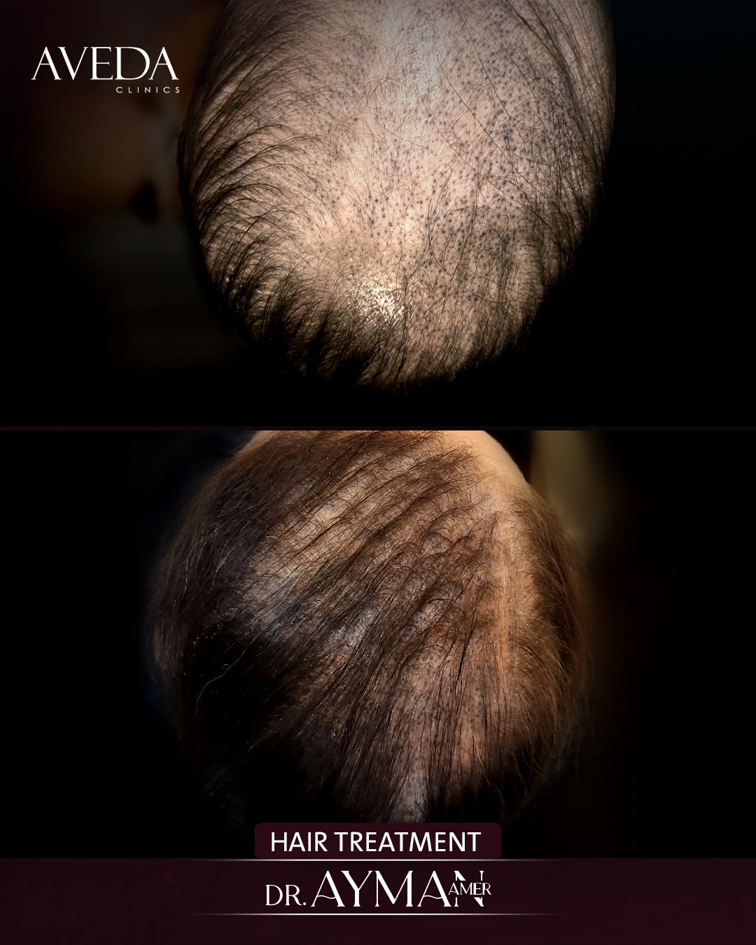 Aveda Clinics Facebook ad