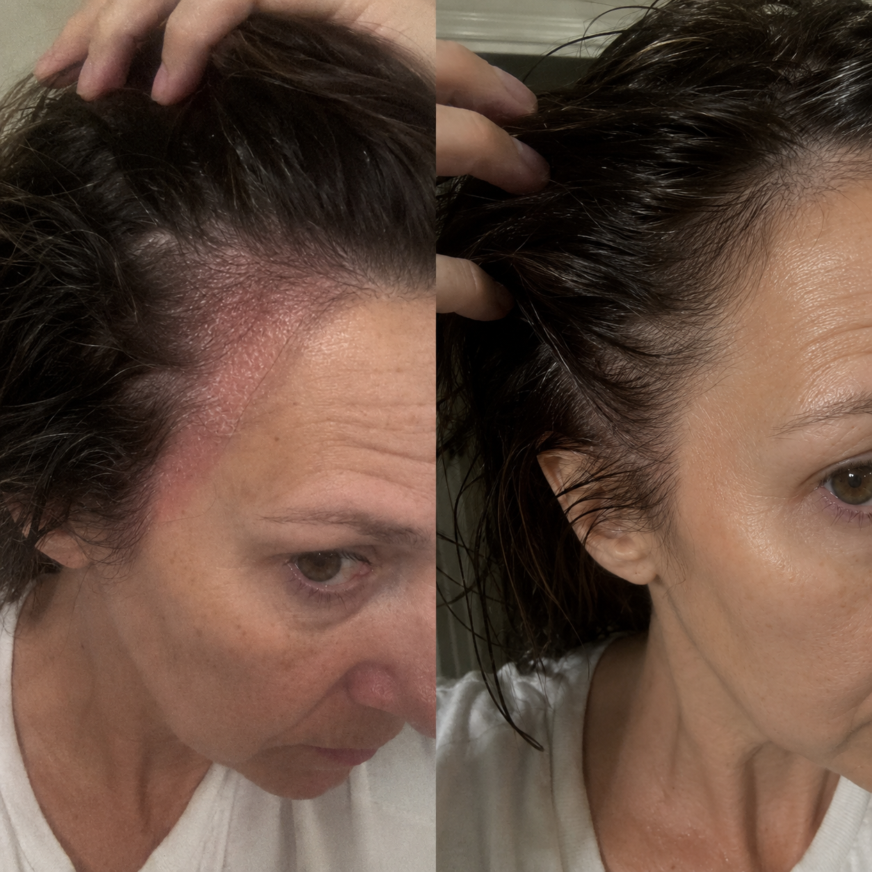 Clara Whitby Facebook ad: Chronic itchy scalp during menopause? read this